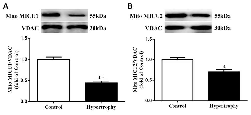 The expressions of mitochondrial MICUs were reduced in Ang-II-induced hypertrophic hearts. (A, B) Western blotting was used to determine the protein expression levels of mitochondrial MICU1 (A) and MICU2 (B) in control and hypertrophic mouse hearts. MICUs, mitochondrial calcium uniporter; MICU1, mitochondrial calcium uptake 1; MICU2, mitochondrial calcium uptake 2. VDAC, voltage-dependent anion channel. VDAC was used as a loading control. Presented values are means ± SEM. N=6-8/group. *P**P