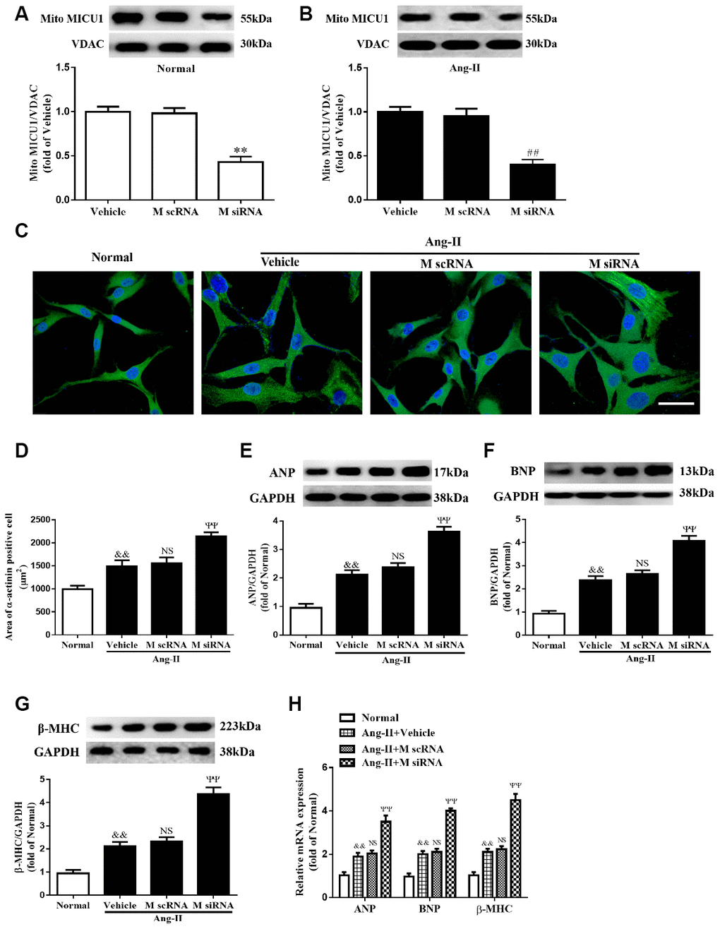 Knockdown of MICU1 exacerbated Ang-II-induced cardiomyocyte hypertrophy in vitro. (A, B) Western blotting was used to measure the transfection efficiency of MICU1 siRNA in neonatal mice ventricular myocytes (NMVMs) (A) and Ang-II treated NMVMs (B). (C, D) Cell surface areas were measured in neonatal mice ventricular myocytes (NMVMs) stimulated with Ang-II (C) and representative images of α-actinin (red)-and DAPI (blue)-stained cardiomyocytes were followed by cell area quantifications (D). Scale bars=10 μm. (E–G) Western blotting was used to measure protein levels of ANP (E), BNP (F) and β-MHC (G) in NMVMs. (H) The mRNA expression of ANP, BNP and β-MHC in NMVMs was detected by qRT-PCR. ANP, atrial natriuretic peptide; BNP, brain natriuretic peptide; β-MHC, β-myosin heavy chain. All the data represent the means ± SEM. N=6-8/group. **P##P&&PΨΨP