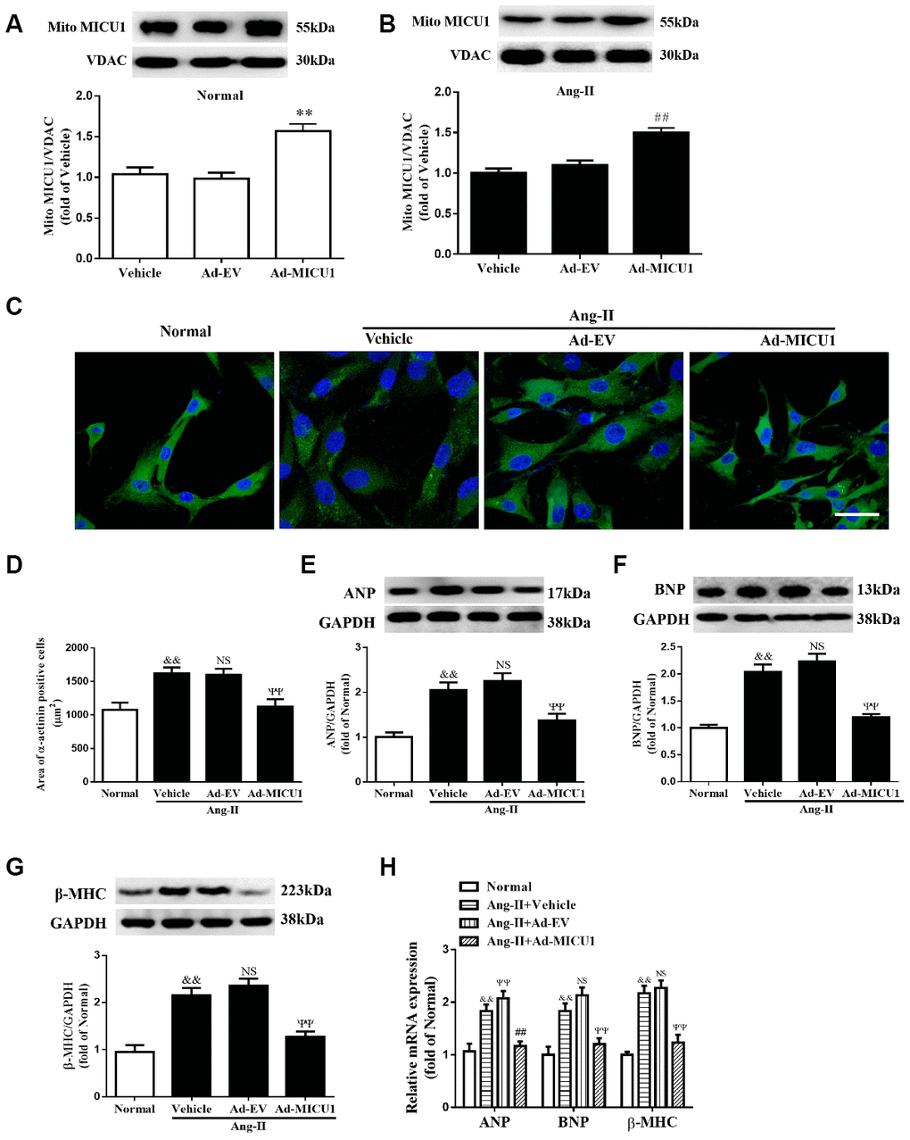 Adenoviral overexpression of MICU1 was resistant to cardiomyocyte hypertrophy in vitro. (A, B) Representative immunoblots and quantification of protein levels of MICU1 in (NMVMs) (A) and Ang-II treated NMVMs (B) infected with Ad-EV and Ad-MICU1 were shown. (C, D) Cell surface areas were measured in NMVMs stimulated with Ang-II (C) and representative images of α-actinin (red)-and DAPI (blue)-stained cardiomyocytes (left) were followed by cell area quantifications (D). Scale bars=10 μm. (E–H) Western blotting and qRT-PCR were used to measure protein levels of ANP, BNP and β-MHC in NMVMs and Ang-II treated NMVMs. All the data represent the means ± SEM. N=6-8/group. **P##P&&PΨΨP