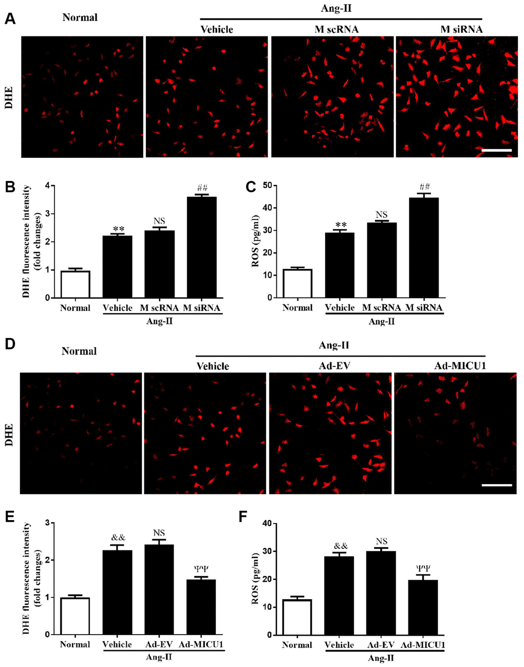 MICU1 mediated cardiomyocyte hypertrophy by modulating oxidation states. (A, B) The ROS levels in cardiomyocytes treated with Ang-II and MICU1 siRNA were analyzed by DHE staining. Representative confocal microscope images (A) and fluorescence quantitation (B) were presented. Scale bars=10 μm. (C) ROS generation in cardiomyocytes treated with Ang-II and MICU1 siRNA was detected by an ELISA kit. (D, E) The ROS levels in NMVMs treated with Ang-II and Ad-MICU1 were analyzed by DHE staining. Representative confocal microscope images (D) and fluorescence quantitation (E) were presented. Scale bars=10 μm. (F) ROS generation in cardiomyocytes treated with Ang-II and Ad-MICU1 was detected by an ELISA kit. Presented values are means ± SEM. N=6-8/group. **P##P&&PΨΨP