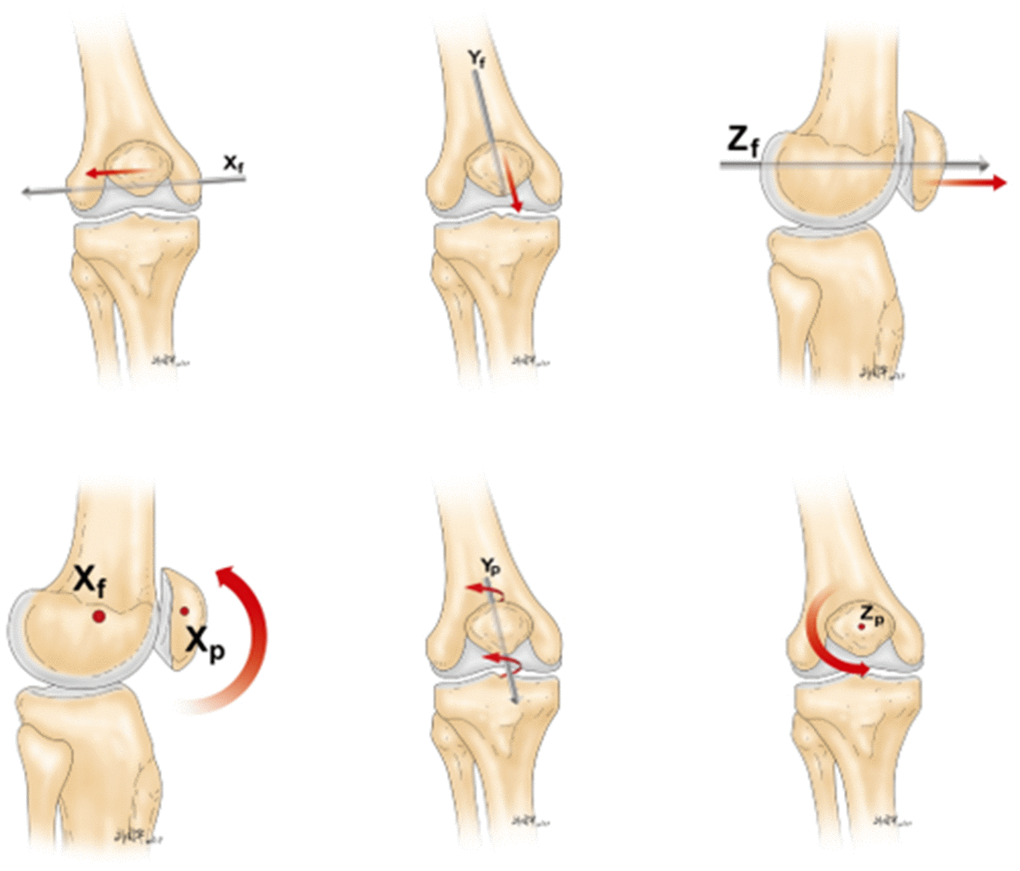Six degrees of freedom movement of the patella relative to the femorotibial joint.