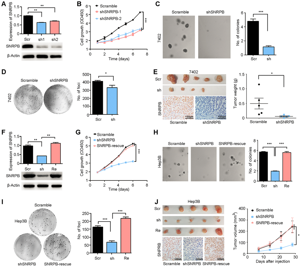 Silencing SNRPB inhibits HCC cell growth in vitro and in vivo. (A) qRT-PCR and western blotting analyses indicating the silencing of SNRPB with shRNAs (shSNRPBs) in 7402 cells. 18S or β-Actin served as the loading control. (B) XTT assay showing that the cell growth rate of 7402 cells was inhibited by shSNRPB. (C) Representative images of decreased colony formation induced by shSNRPB in soft agar assays. The results are summarized in the right panel. (D) Representative image of foci formation in monolayer culture of 7402 cells with silenced SNRPB. The numbers of foci are summarized in the right panel. (E) Images of the xenograft tumors formed in nude mice injected with shSNRPB- and scramble-transfected cells. The weights of xenograft tumors are summarized in the right panel. IHC staining was performed to confirm the expression of SNRPB in xenograft tumors (lower panel). Scale bars = 100 μm. (F) qRT-PCR and western blotting analyses showing the expression levels of SNRPB in Hep3B cells transfected with SNRPB-shRNA (shSNRPB) and SNRPB-overexpressing vector for rescue (SNRPB-rescue). 18S or β-Actin served as the loading control. (G–I) Cell growth curves (G), colony formation (H) and foci formation (I) assays showed that transfection with SNRPB could rescue the cell growth inhibited by shSNRPB in Hep3B cells. (J) Images of the xenograft tumor formed in nude mice injected with scramble vector-, shSNRPB- and SNRPB-rescue-transfected cells. The volume curves of xenograft tumors are summarized in the right panel. IHC staining was performed to confirm the expression of SNRPB in xenograft tumors (lower panel). Scale bars = 100 μm.