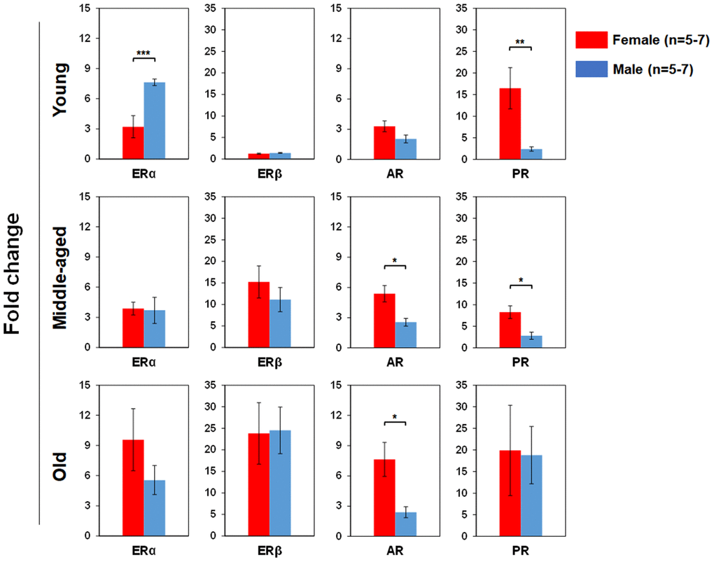 Comparisons of relative gonadal SexHR gene expression between male and female of young, middle-aged and old mice. Left panels: ERα gene expression between male and female of young, middle-aged and old mice. Middle-left panels: ERβ gene expression between male and female of young, middle-aged and old mice. Middle-right panels: AR gene expression between male and female of young, middle-aged and old mice. Right panels: PR gene expression between male and female of young, middle-aged and old mice. ERα: estrogen receptor α, ERβ: estrogen receptor β, AR: androgen receptor, and PR: progesterone receptor. * P 