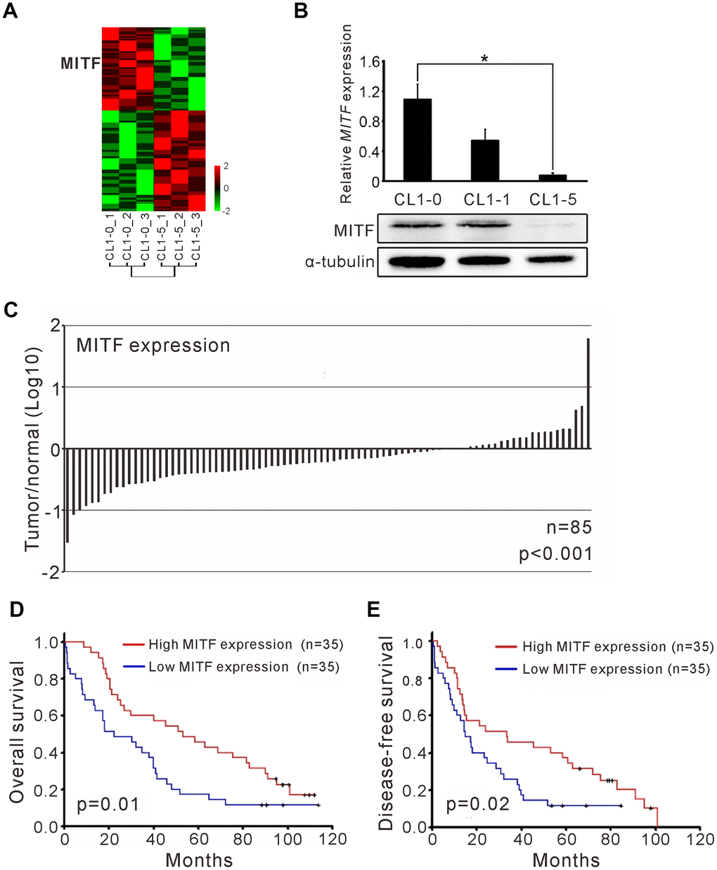 The MITF expression associated with cancer invasiveness and better outcome of NSCLC patients. (A) Heatmap of the gene expression profiles in CL1-0 and CL1-5 were presented. Each cell line was analyzed for three replicates and the significant microarray probes with 5-fold change were applied. MITF was one of the significant expressed genes. The scale was used the z-score. (B) MITF mRNA and protein level was measured by quantitative real-time PCR and immunoblot. *p C) The ratio of MITF expression in tumor and adjacent normal parts of NSCLC patients (n = 85). The scale is the base 10 logarithm of the ratio of MITF expression. The difference of MITF expression between the two groups was estimated by Wilscoxon matched-pairs test. (D) Kaplan–Meier survival analysis estimated the overall survival of NSCLC patients by the MITF expression. (E) Kaplan–Meier survival analysis estimated the disease-free survival of NSCLC patients by the MITF expression. The MITF expression of clinical specimen was measured by real-time RT-PCR with TaqMan probe. The p-value for survival was estimated by log-rank test.