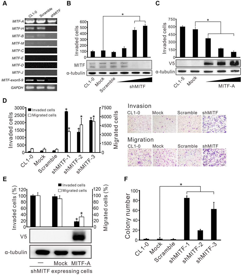 MITF promotes cell invasion and migration in lung adenocarcinoma cells. (A) The silencing efficiency of shMITF to different MITF isoforms in CL1-0 cells was measured by isoform-specific RT-PCR. Controls included RT-PCR for the common MITF exons 5-9 and GAPDH. (B) The cell invasive ability of CL1-0 cells was assayed after transiently delivering the shMITF expressing plasmids with different doses. Mock: vector transfectant; Scramble: scramble transfectant. *p C) The cell invasive ability of CL1-5 cells was assayed after overexpression of MITF-A with different doses. *p D) The cell invasive and migratory abilities of stably MITF-silenced cells were assayed by using Boyden chamber assays with and without Matrigel, respectively. *pE) Re-expressed MITF-A in stably MITF-silenced cells were assayed for the cell invasion and migration. *p F) The anchorage-independent colony formation ability of stably MITF-silenced cells was assayed. Scale bar, 100 μm. *p 