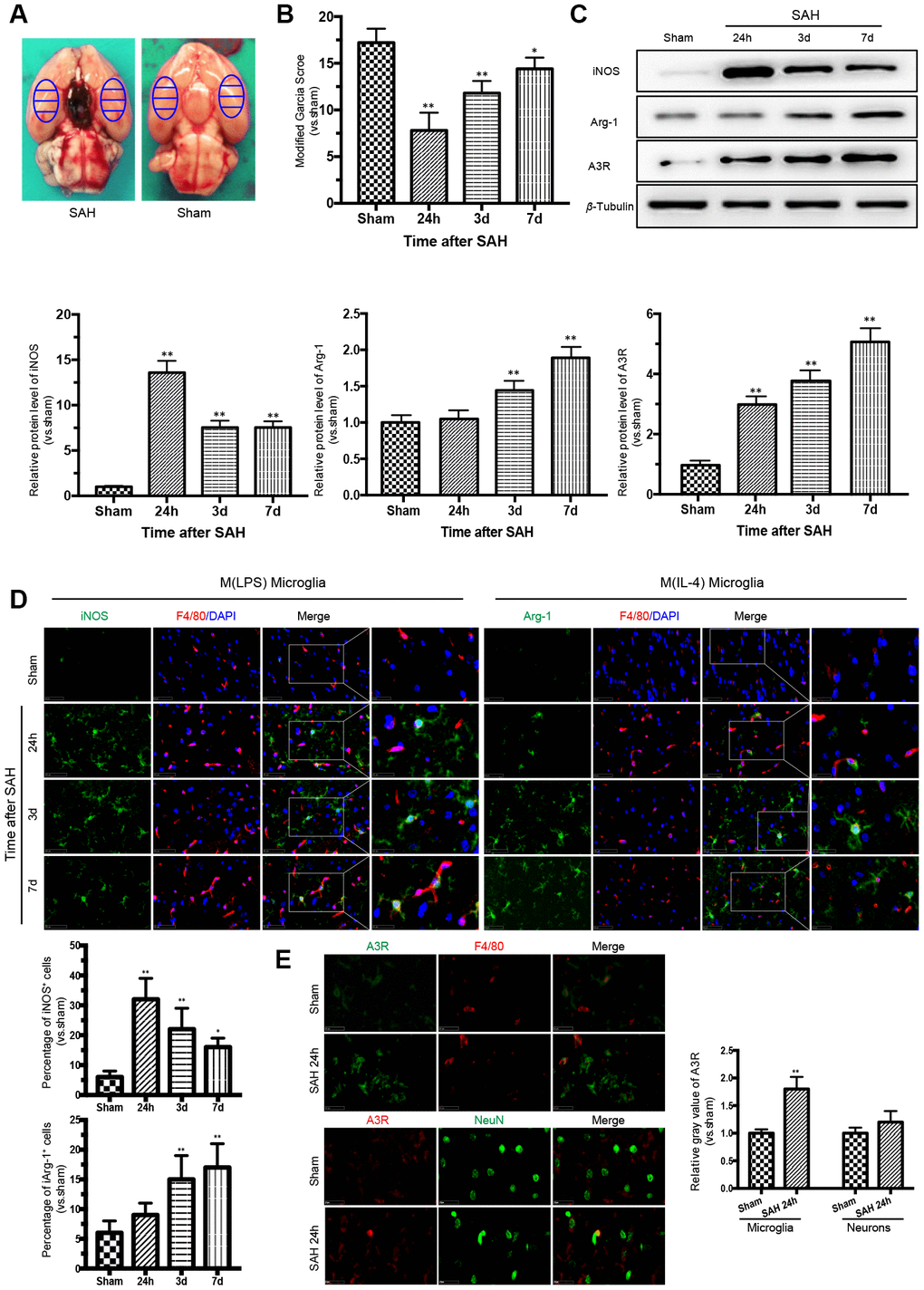 Time courses of the neurological scores, phenotypic characteristics of microglia and expression of adenosine A3 receptor after subarachnoid hemorrhage (SAH). (A) Representative images showing blood clots deposited around the circle of Willis and schematic representations of the areas for analysis. (B) The modified Garcia score was significantly reduced after SAH, with the lowest point at 24 h. (C) Western blot analysis showing the protein expression levels of nitric-oxide synthase (iNOS), arginase-1 (Arg-1), and adenosine A3 receptor (A3R) at 24 h, 3 days, and 7 days after SAH. (D) Immunofluorescence staining showing the expression of iNOS and Arg-1 in the cerebral cortex. iNOS- and Arg-1-positive cells were analyzed quantitatively. (E) A3R staining was observed in the cerebral cortex at 24h after SAH. F4/80 and NeuN was respectively used as a microglia and neurons marker. The relative gray value of A3R were quantified. n=5 in each group. Data are shown as the mean ± SD. *p p 