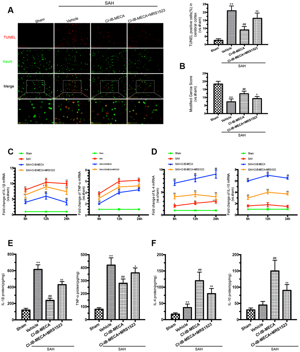 The A3R agonist ameliorated neuronal apoptosis and improved neurobehavioral outcomes by regulating neuroinflammatory after SAH. (A) Apoptotic neurons and percentage of TUNEL-positive cells in the cerebral cortex 24 h after SAH. NeuN was used as a neuron marker. (B) Neurologic score was performed 24 h after SAH. (C, D) The changes of IL-1β, TNF-α, IL-4 and IL-10 mRNA at 6 h, 12 h and 24 h after SAH. (E, F) The inflammatory cytokines was measured by enzyme-linked immunosorbent assay at 24 h after SAH. n=5 in each group. Values are shown as the mean ± SD. *p p p p p 