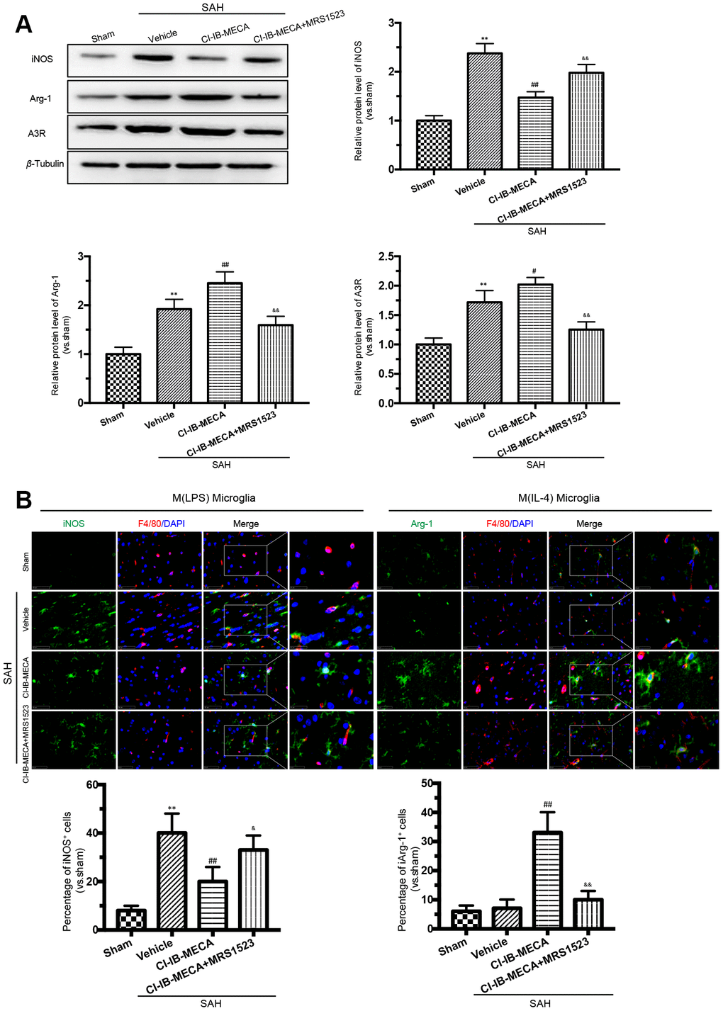 A3R agonist CI-IB-MECA promotes microglia towards to the M(IL-4) phenotype in rat 24 h after SAH. (A) Western blot analysis showing the expression of iNOS and Arg-1 after injection of CI-IB-MECA with or without MRS1523 24 h after SAH. A3R protein expression increased 24 h after SAH and was further increased after CI-IB-MECA treatment, which was partially reversed by the A3R antagonist MRS1523. (B) Immunofluorescence staining showing the M(LPS)-associated marker iNOS or the M(IL-4)-associated marker Arg-1 in the cerebral cortex 24 h after SAH. Both M(LPS) and M(IL-4) microglia were quantified. n=5 in each group. Values are shown as the mean ± SD. **p p p p p 