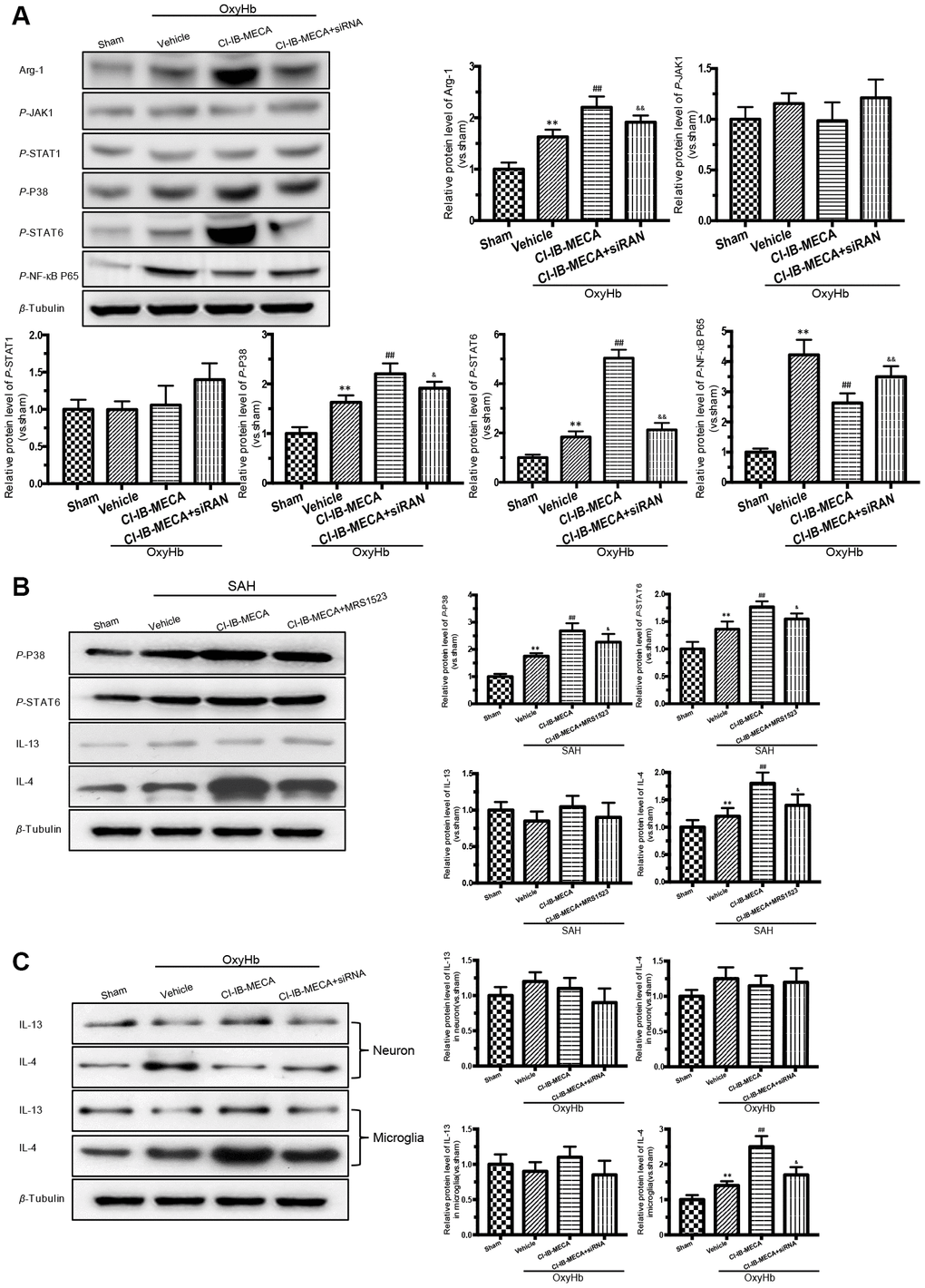 Activation of A3R induced the expression of Arg-1 in vitro, and enhanced the activation of P38, STAT6 both in vitro and in vivo. (A) Western blot analysis showing the expression of Arg-1 and phosphorylated JAK1, STAT1, P38, STAT6 and NF-κB P65 24 h after OxyHb treatment. The protein levels were quantified. (B) Effects of the A3R agonist (CI-IB-MECA) and antagonist (MRS1523) on the P38/STAT6 pathway, IL-13 and IL-4(STAT6 activator) in vivo 24 h after SAH. Western blot analysis showing the protein of phosphorylated P38 (p-P38), STAT6 (p-STAT6), IL-13 and IL-4 under the indicated treatments. (C) Effect of CI-IB-MECA on the expression of IL-13 and IL-4, in neuron or microglia in vitro. β-Tubulin was used as a loading control. n=5 in each group. Data are shown as the mean ± SD. **p p p p 