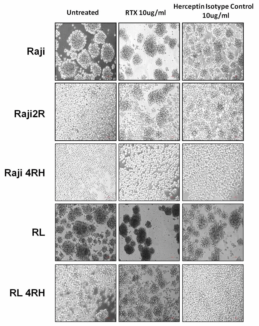 Cellular aggregation in RSCL and RRCL treated with rituximab. Rituximab enhances cellular aggregation in both ICAM-1 high expressed RSCL and ICAM-1 low expressed RRCL.