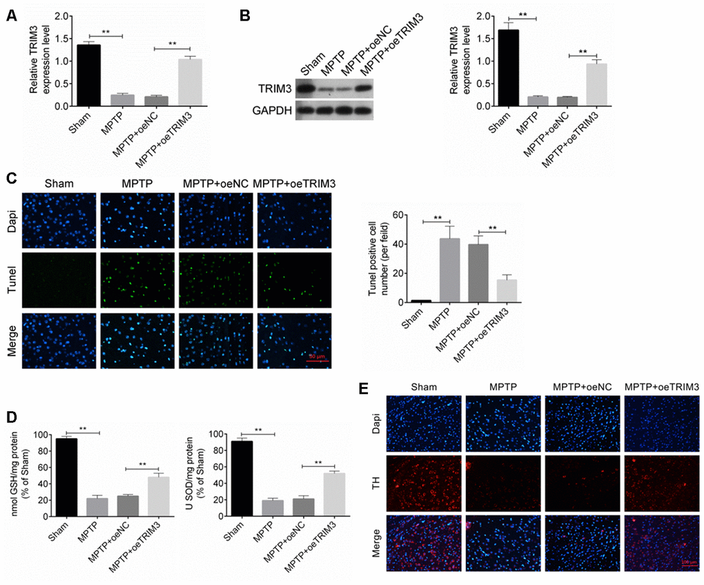 TRIM3 inhibited apoptosis of brain tissue cells in PD mice. (A and B) TRIM3 mRNA and protein expression in the midbrain of mice in MPTP + oeTRIM3 group was significantly elevated when compared with MPTP + oeNC group. (C) Markedly lower Tunel positive cell number was found in the midbrain of mice in MPTP + oeTRIM3 group relative to MPTP + oeNC group. (D) Prominently higher GSH and SOD levels were observed in the midbrain of mice in MPTP + oeTRIM3 group when compared with MPTP + oeNC group. (E) Compared with MPTP + oeNC group, more TH positive expression dopaminergic neurons were observed in MPTP + oeTRIM3 group. ** P 