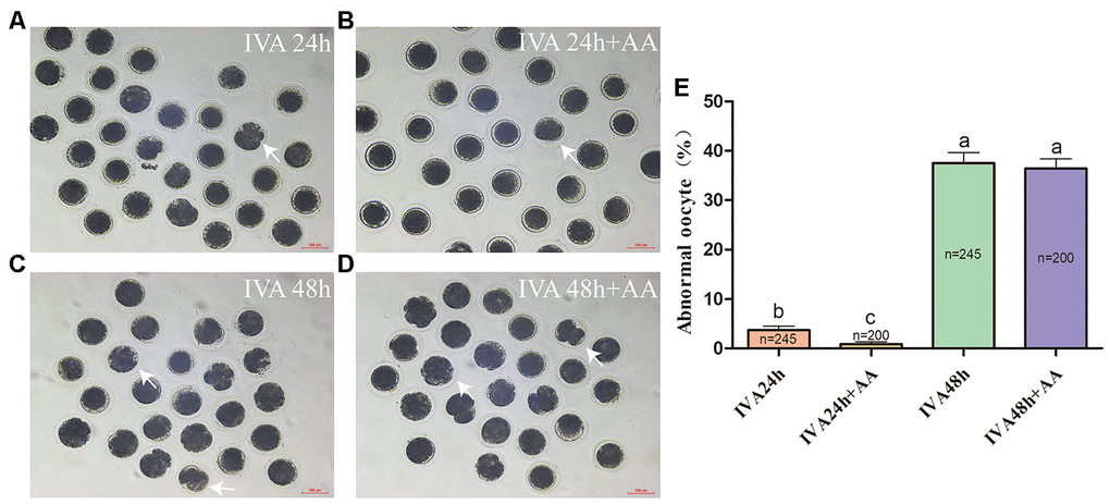 Changes in the morphology of in vitro aged porcine oocytes after AA supplementation. (A) 24-h in vitro aged oocytes; (B) 24-h in vitro aged oocytes supplemented with 10 μM AA; (C) 48-h in vitro aged oocytes; (D) 48-h in vitro aged oocytes supplemented with 10 μM AA; (E) morphological changes in porcine oocytes recovered at different culture time points from the AA supplementation groups. Representative morphologically abnormal in vitro aged oocytes (white arrows) were examined by optical microscopy. Scale bar=100 μm. The numbers of oocytes examined in each group are shown by the bars. Statistically significant differences are indicated by different letters (p).