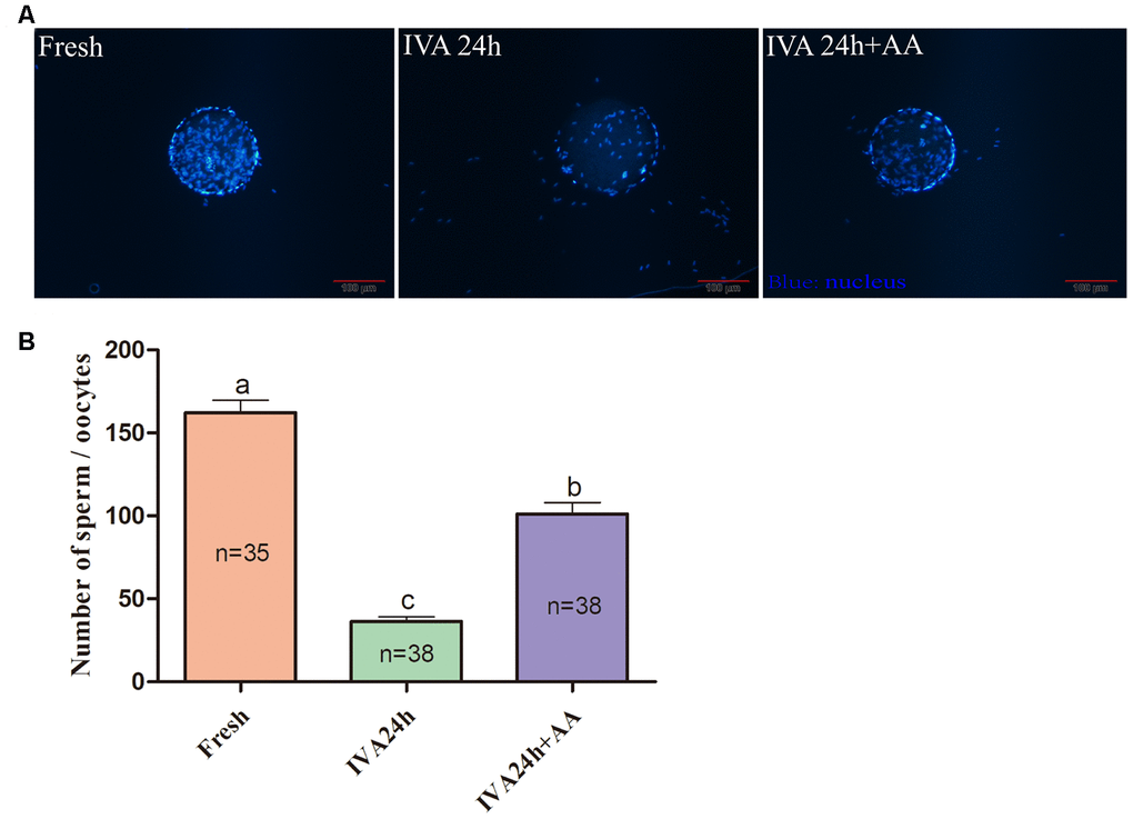 Effect of AA supplementation on sperm binding to the zona pellucida of porcine in vitro aged oocytes after in vitro fertilization. (A) Representative fluorescence images of sperm binding to the surface of the zona pellucida surrounding oocytes staining with Hoechst 33342 in each group. Scale-bar=100 μm. (B) Number of sperm binding to the surface of the zona pellucida surrounding oocytes in each group. The number of oocytes examined in each group is shown by the bars. Statistically significant differences are indicated by different letters (p).