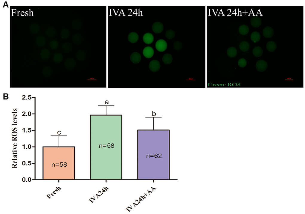Effects of AA supplementation on the production of intracellular ROS in porcine IVA oocytes. (A) Representative fluorescence images of intracellular ROS in oocytes in each group. Scale bar=100 μm. (B) Relative intracellular ROS levels in oocytes in each group. The number of oocytes examined in each group is shown by the bars. Statistically significant differences are indicated by different letters (p).