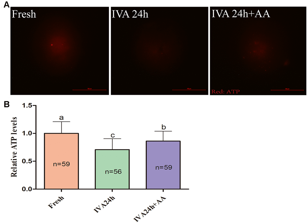 Effects of AA supplementation on the ATP production of in vitro aged porcine oocytes. (A) Representative fluorescence images of ATP staining in oocytes from each group. Scale bar=100 μm. (B) Relative ATP levels in oocytes from each group. The number of oocytes examined in each group is shown by the bars. Statistically significant differences are indicated by different letters (p).