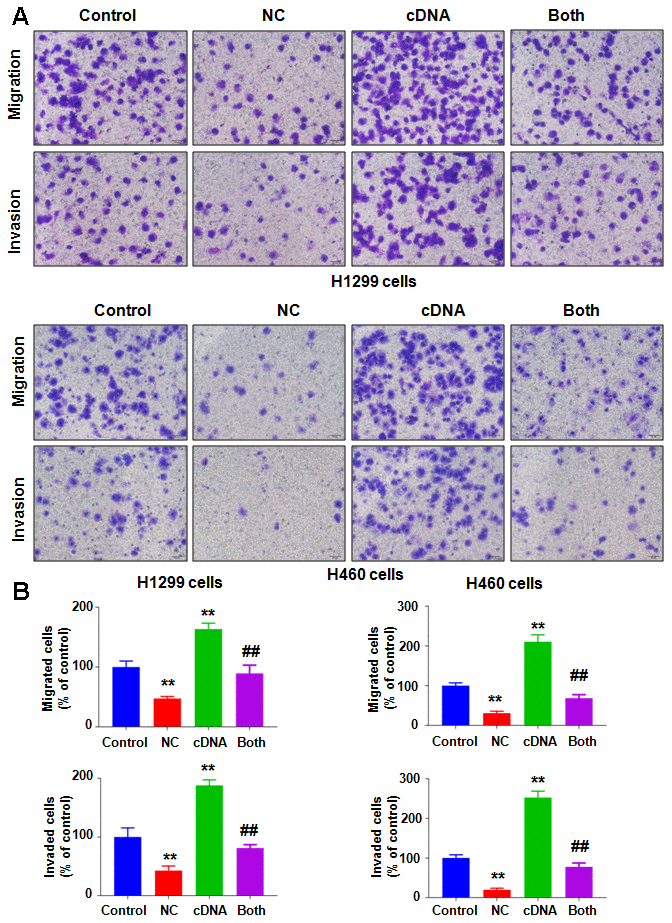 Overexpression of NEDD4 attenuates NC-involved inhibition of cell motility. (A) Cell migration and invasion were evaluated in lung cancer cells after the combination treatments. (B) Quantitative data are shown for panel A. **P##p