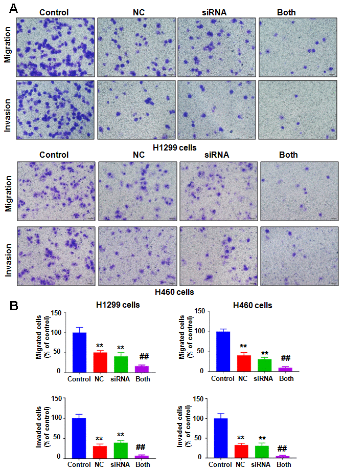 Downregulation of NEDD4 enhances NC-involved inhibition of cell motility. (A) Cell migration and invasion were evaluated in lung cancer cells after combination treatments. NC: Nitidine chloride; siRNA: NEDD4 siRNA; Both: NEDD4 siRNA plus NC. (B) Quantitative data are shown for motility. **P##p