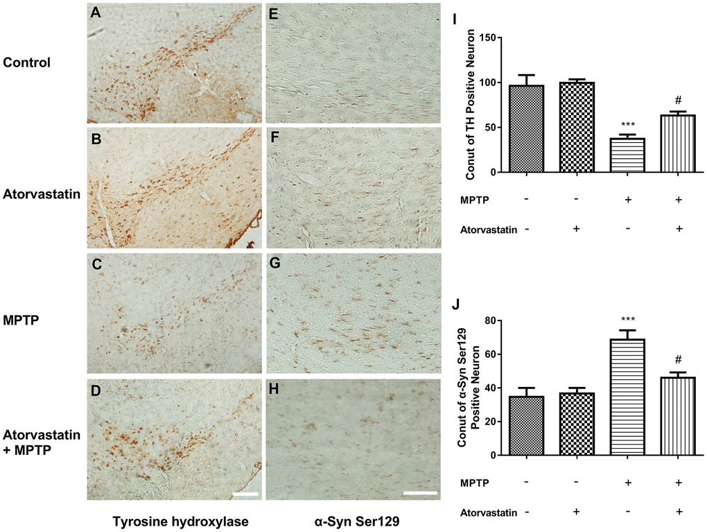 Atorvastatin reduces the number of dead MPTP-induced nigral neurons in the autophagic flux marker PD mouse. Immunohistochemistry of tyrosine hydroxylase in the substantia nigra neurons of an autophagic flux marker mouse model (A–D). Immunohistochemistry of α-Syn Ser129 substantia nigra neurons in an autophagic flux marker mouse model (E–H). Bar = 100 μm. Quantitative analysis of TH positive neurons and α-syn ser129 positive neurons (I, J). The results are expressed as ***p #p 