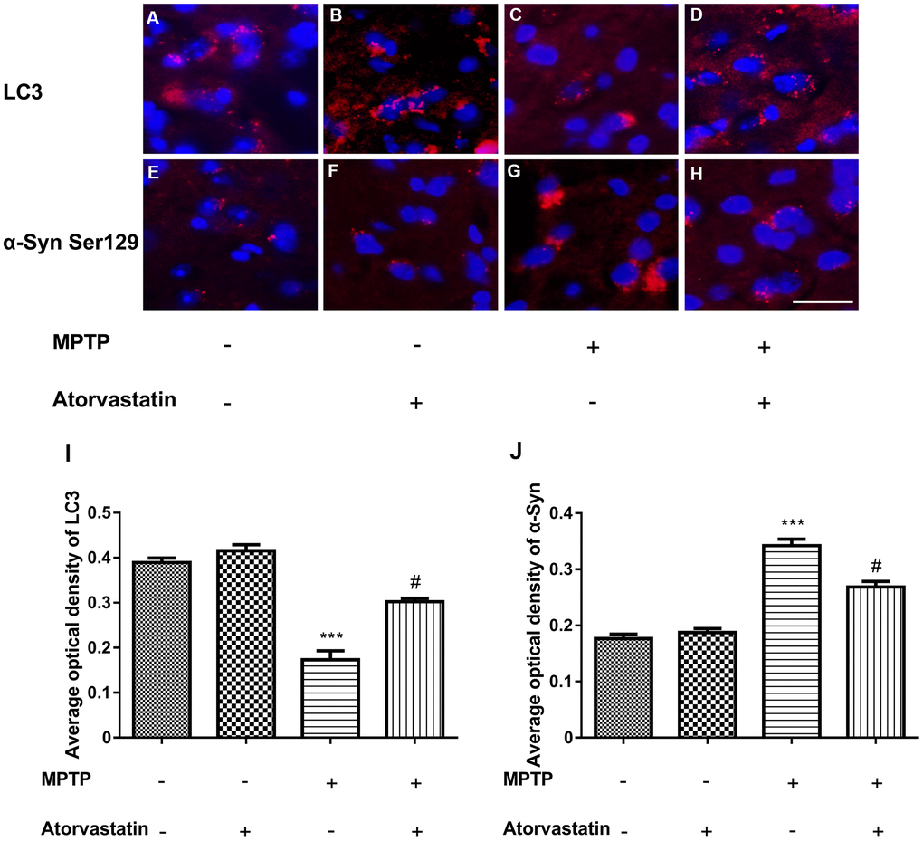 Changes in the expression of LC3 and α-syn Ser129 in MPTP mice. The expression of LC3 in the substantia nigra neurons of C57BL/6 mice (A–D). The expression of α-Syn Ser129 in the substantia nigra neurons of C57BL/6 mice (E–H). Bar = 20 μm. Quantitative analysis of LC3 and α-Syn average optical (I, J). The results are expressed as ***p #p 