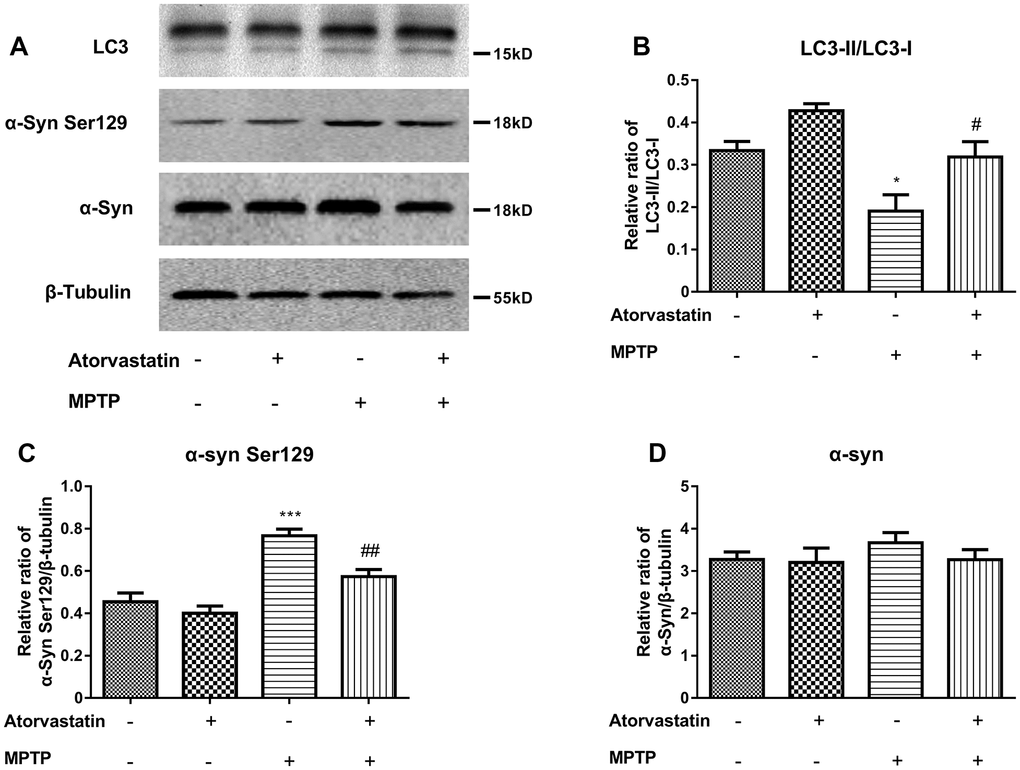 Western blot results show the protein expression (A) of LC3-II/LC3-I (B), α-Syn Ser129 (C) and α-Syn (D) in the substantia nigra neurons of C57BL/6 mice. The results compared to atorvastatin/MPTP (-/-) are expressed as *p ***p #p ##p 