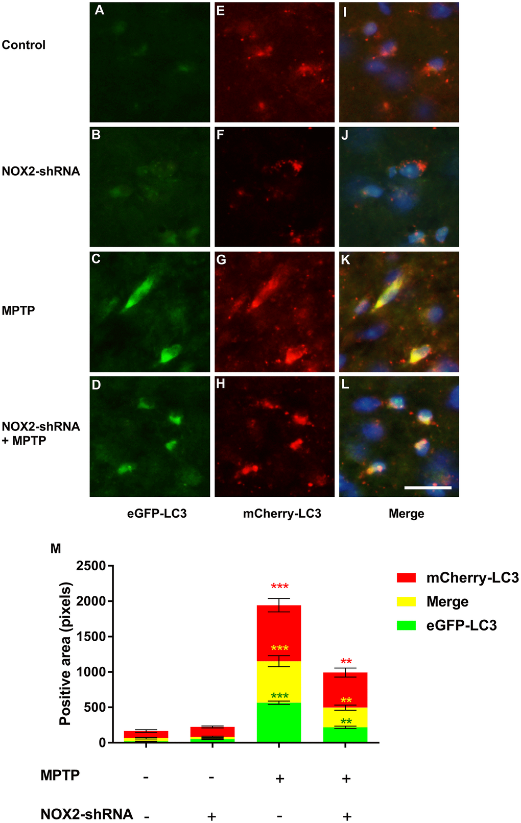 The effect of NOX2 inhibition on autophagic flux. The expression of eGFP-LC3 in the substantia nigra neurons of the marker mouse model (A–D). The expression of mCherry-LC3 in the substantia nigra neurons of the autophagic flux marker mouse model (E–H). The merged figures show the expression of eGFP-mCherry-LC3 (I–L). Bar = 20 μm. Quantitative analysis of eGFP, mCherry and merged positive area (M). The results are expressed as ***p p 