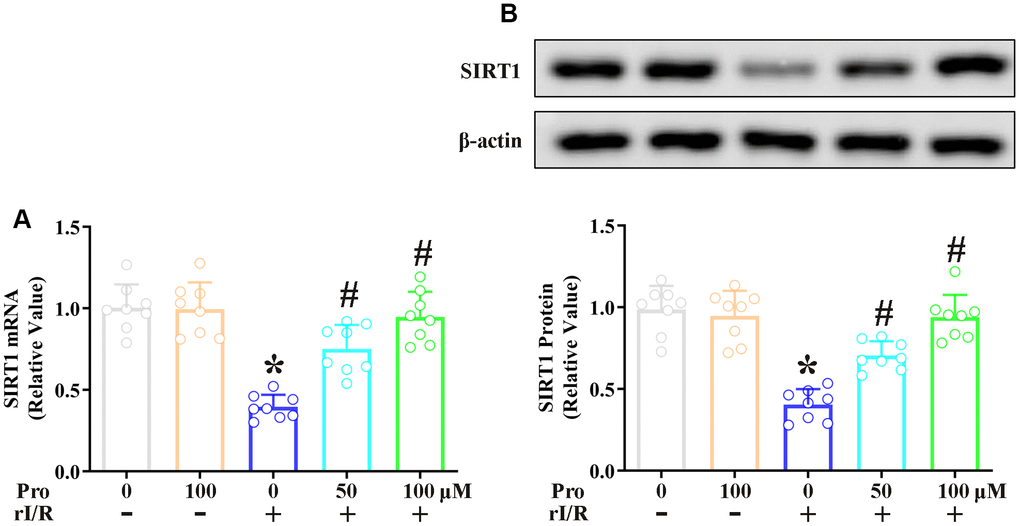 Propofol suppresses the rI/R-induced downregulation of SIRT1 in rat alveolar macrophages. NR8383 cells were incubated with serum from sham or rI/R rats, with or without propofol (50 or 100 μM) for 24 h. (A) Real-time PCR was used to measure SIRT1 mRNA levels. (B) Western blotting was used to measure SIRT1 protein levels (*P #P 