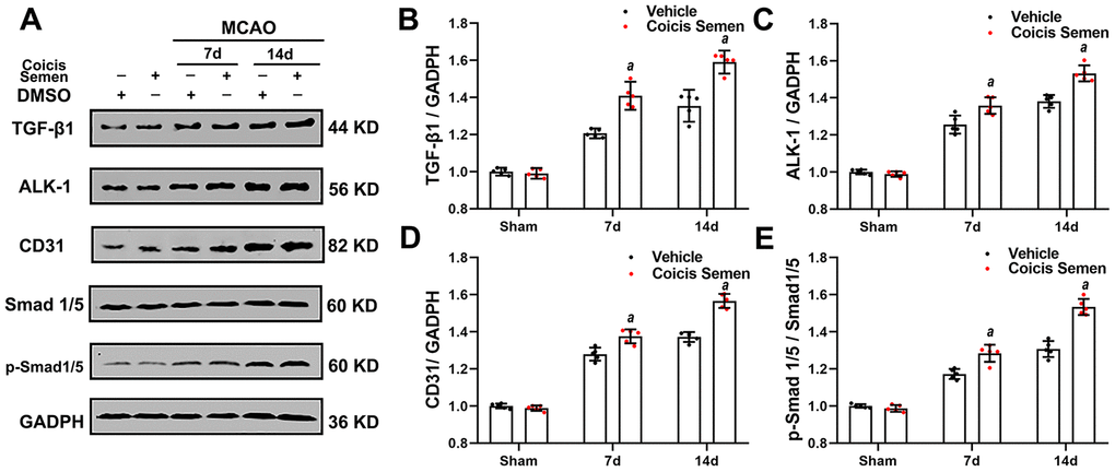 Coicis semen treatment activated the TGF-β1-ALK1-Smad1/5 signaling pathway after stroke. (A) Western blot showing that Coicis Semen treatment increased the expression and phosphorylation of the TGF-β1-ALK1-Smad1/5-associated proteins TGF-β1, ALK-1, Smad 1/5, p-Smad 1/5 and CD31 at 7 and 14 days after stroke. (B–E) Quantitative analysis of the protein levels of TGF-β1, ALK-1, p-Smad 1/5 and CD31 in ischemic cortical tissue. Mean ± SD. n = 5. aP t-test.