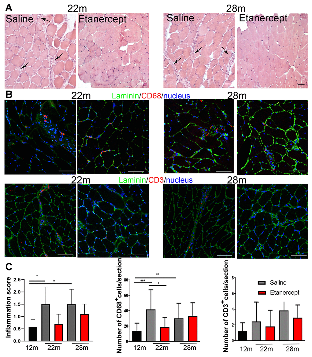 TNFα blockade reduced inflammation. (A) Representative images of muscle sections analyzed at 22 or 28 months of age in control (saline) and Etanercept-treated mice. Scale bar=50 μm. Arrows indicate perivascular inflamed areas. (B) Representative images of muscle CD68- and CD3-positive cells (both in red) in control and Etanercept-treated muscle sections at 22 and 28 months of age. Laminin staining (green) identifies fibers while cell nuclei are blue. Scale bar=50 μm (magnification of 16x acquisition). (C) Inflammation score and CD68+ and CD3+ cell number evaluated in 12 months old mice and in control and Etanercept-treated mice at 22 and 28 months of age.