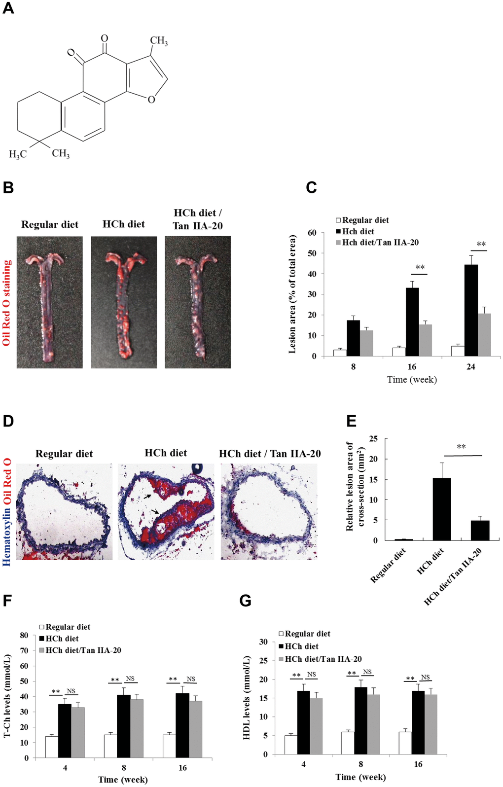 Effects of Tan IIA on HCh diet-induced AS lesion formation, serum lipid levels and cytokine productions in ApoE-/- mice. (A) Molecular structure of Tanshinone IIA. (B) AS lesions stained by Oil Red O in the aorta of ApoE-deficient mice fed on the different diets (regular diet, HCh diet and HCh diet plus Tan IIA (20 mg/kg/day)). (C) Percentage of the lesion area of the aorta was calculated as the ratio of the lesion area to the total area. (D) Histological images of frozen section of the lesions stained with Oil Red O and Haematoxylin/eosin (HE). (E) Relative lesion area of the section of AS in the aorta. Average areas of AS lesions were calculated from 12 sections in ApoE-deficient mice fed on the different diets. (F–G) Levels of T-Ch and HDL-Ch in the sera of ApoE-deficient mice fed with different diets for 16 weeks.