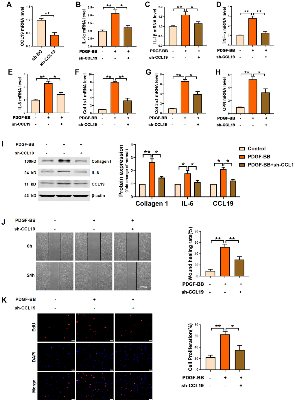 Effects of silencing CCL19 on VSMCS. Detection of silencing efficiency of sh-CCL19 plasmid was detected by qRT-PCR. (A) Knockdown of CCL19 inhibited mRNA level of IL1-α (B), IL-1β (C), TNF-α (D), IL-6 (E) and collagen1 (F), collagen3 (G) and OPN (H) induced by PDGF-BB.n=5 (I) Western blot show collagen1 and IL-6 protein expression. n = 4. Migration (J) and proliferation (K) of VSMCS after silencing CCL19. n = 6. *P