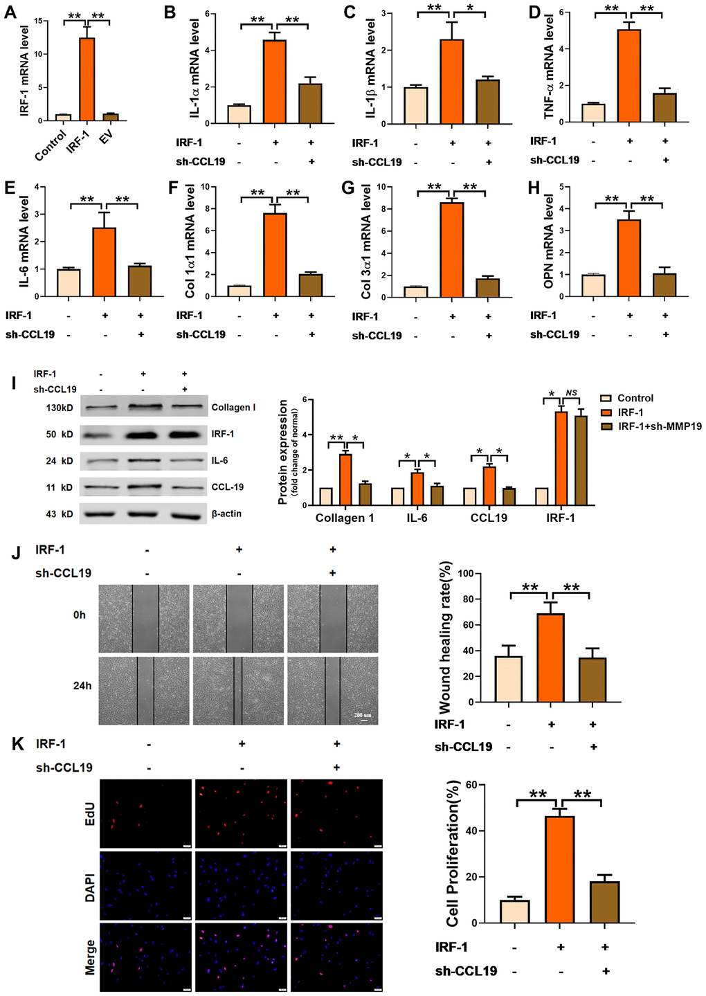 Effects of IRF-1 on VSMCS though CCL19. (A) Detection of overexpression efficiency of IRF-1 plasmid by qRT-PCR. n=5. Knockdown CCL19 reversed IRF-1 induced mRNA expression of inflammatory cytokine IL1-α (B), IL-1β (C), TNF-α (D), IL-6 (E) and the deposition of ECM collagen1 (F), collagen3 (G) and OPN. (H, I) Western blot showed the collagen1, IL-6 and CCL19 protein expression induced by IRF-1, but reduced by sh-CCL19. n = 4. Migration (J) and proliferation (K) of VSMCS of IRF-1 overexpression, with or without sh-CCL19. n = 6. *P