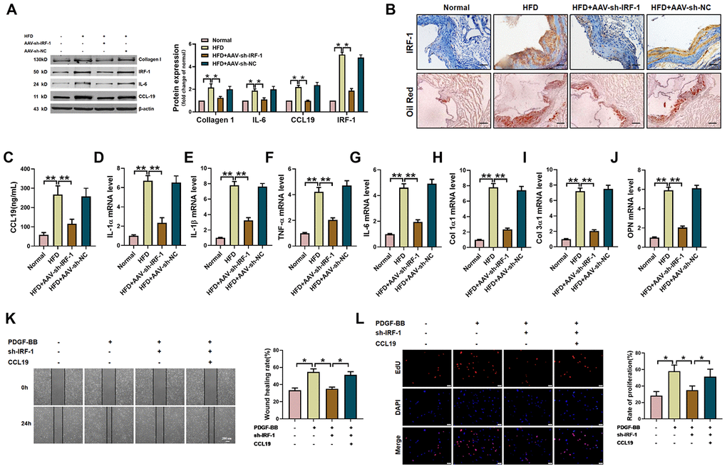 IRF-1 knockdown inhibits AS of mice and proliferation and migration of VSMCS. (A) Western blot was used to analyze the protein level of IL-6, Collagen 1, CCL19 and IRF-1 in AS mice and AAV-sh-IRF-1 treated mice. β-actin was used as an internal control. n=4 (B) Representative images of IHC staining and oil red staining in AS model mice aorta tissues and normal aorta tissues. Bar=50 μm. Knockdown IRF-1 reversed HFD induced mRNA expression of CCL19 (C), inflammatory cytokine IL1-α (D), IL-1β (E), TNF-α (F), IL-6 (G) and the deposition of ECM collagen1 (H), collagen3 (I) and OPN (J). n=56. In vitro, sh-IRF-1 led migration (K) and proliferation (L) of VSMCS. n=6. *P