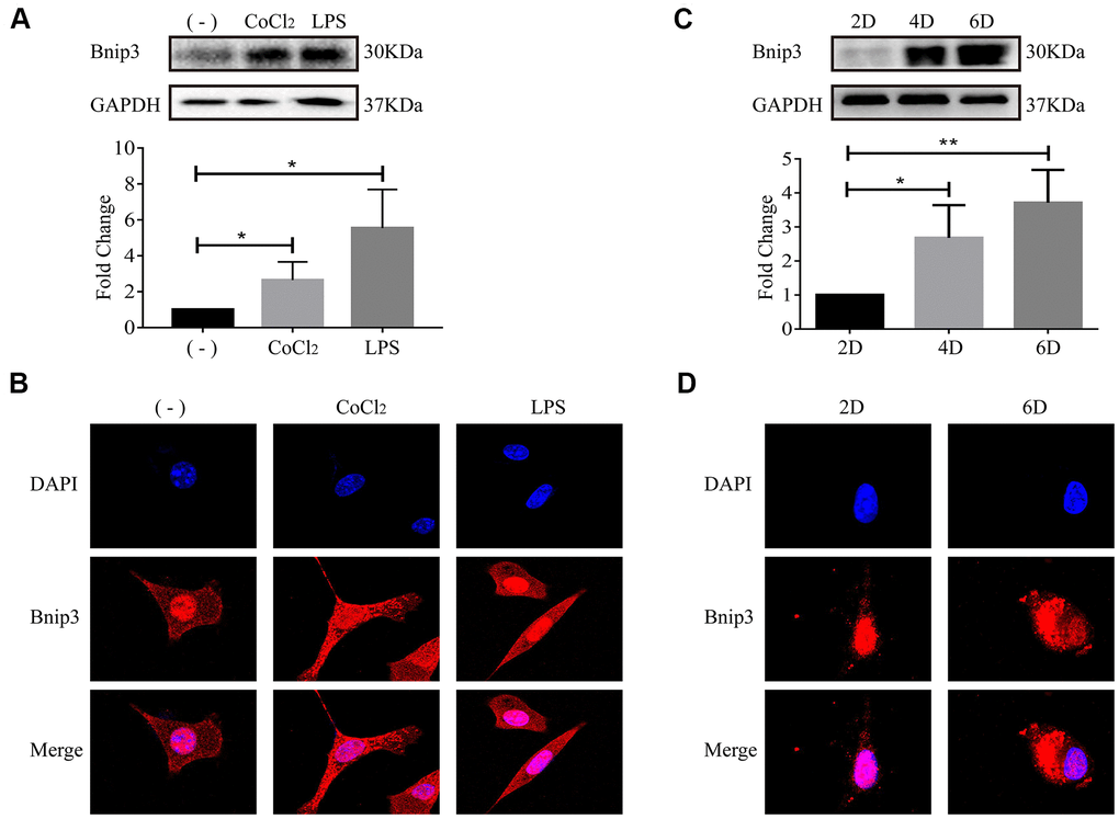 The activation of hepatic stellate cells induced Bnip3 expression and its cytoplasmic translocation in vitro. LX-2 cells were treated with 100 μM CoCl2 or 2 μg/ml LPS for 8 h. (A) Cells were collected at indicated time and cell lysates were subjected to detect Bnip3 with Western blot. Densitometric analysis for Western blot was performed and data were expressed as mean ± SD, *P B) Immunofluorescence assay was performed to detect Bnip3 (Cy3) in CoCl2- or LPS-treated LX-2 cells. Culture-activated primary HSCs from mice were cultured up to 2 days, 4 days or 6 days. (C) Cells were collected at indicated time and cell lysates were subjected to detect Bnip3 with Western blot. Densitometric analysis for Western blot was performed and data were expressed as mean ± SD, *P P D) Immunofluorescence assay was performed to detect Bnip3 (Cy3) and images were captured by confocal microscope.