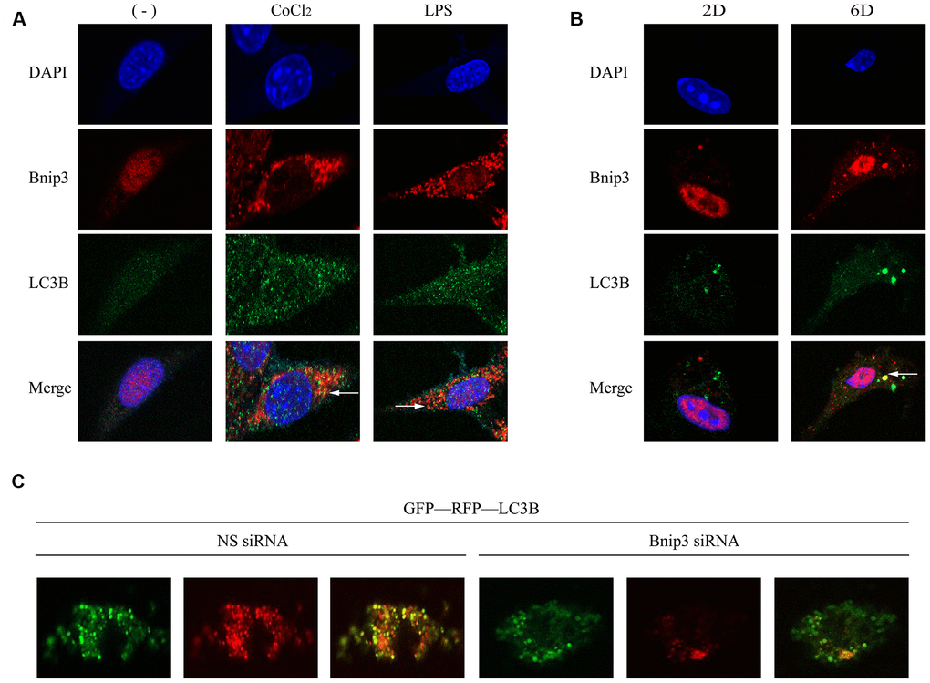 Bnip3 was partially co-localized with autophagosomes in activated HSCs and inhibition of Bnip3 led to the blockage of the autophagic flow. LX-2 cells were treated with 100 μM CoCl2 or 2 μg/ml LPS for 8 h. Culture-activated primary HSCs from mice were cultured up to 2 days or 6 days. Immunofluorescence assay was performed to detect Bnip3 (Cy3) and LC3B (FITC) in LX-2 cells (A) and culture-activated primary HSCs from mice (B) by confocal microscopy. (C) Primary HSCs were isolated from mice and seeded in coverslips. Cells were transfected with specific siRNA targeting Bnip3 as cells were cultivated up to day 2 and GFP-RFP-LC3B plasmid was transfected into cells 24h later. Cells were fixed at day 6 and images were captured by confocal microscope to observe the formation of autophagosomes.