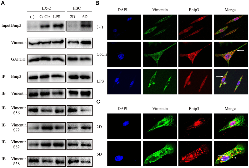Bnip3 interacted with vimentin in activated hepatic stellate cells. LX-2 cells were treated with 100 μM CoCl2 or 2 μg/ml LPS for 8 h. Culture-activated primary HSCs from mice were cultured up to 2 days or 6 days. (A) 300μg cell lysates of LX-2 cells and 150μg cell lysates of primary HSCs from mice were collected and immunoprecipitated with anti-Bnip3, followed by immunoblotting with anti-vimentin, anti-phosphorylated vimentin S56, S72, S82 and S38. (B, C) Immunofluorescence assay was performed to detect Bnip3 (Cy3) and vimentin (FITC) in LX-2 cells (B) and culture-activated primary HSCs from mice (C) by confocal microscopy.
