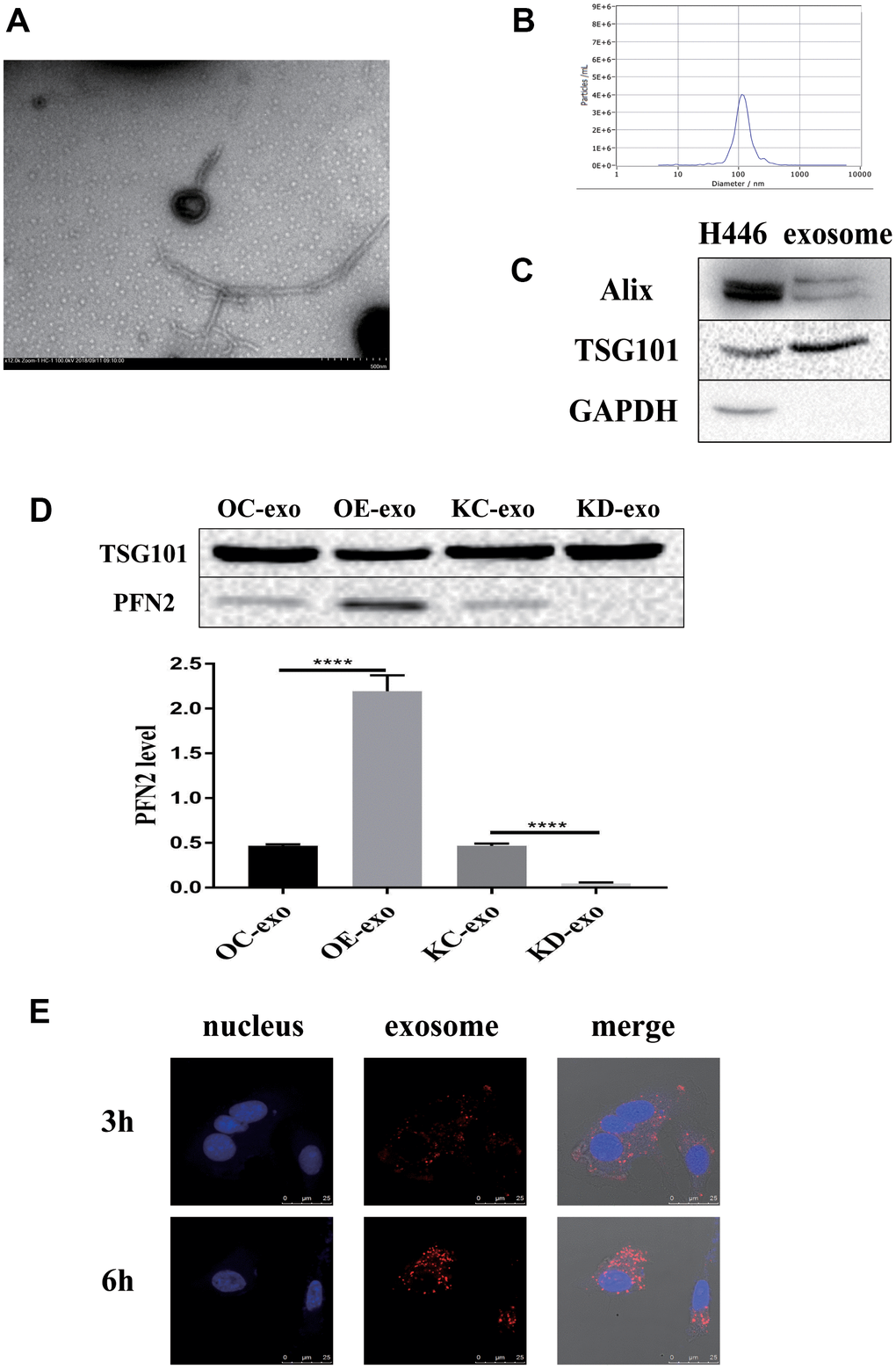 Exosomes derived from H446 cells. The exosomes are identified using TEM, NTA and western blot (A–C). PFN2 expression in exosomes derived from different kinds of H446 is detected using western blot (D). Exosomes can be internalized by H446 cells (E).