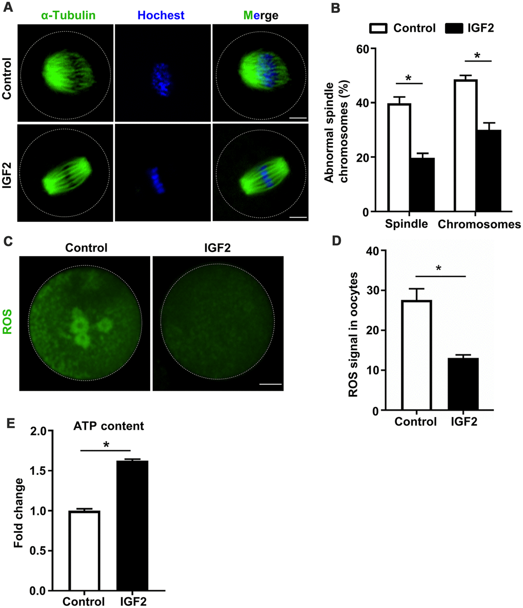 IGF2 ameliorates the meiotic defects of aged mouse oocytes. (A) Representative images of spindle/chromosome organization in control and IGF2-treated oocytes from aged mice. Spindles were stained with an antibody against α-tubulin (green), and chromosomes were counter-stained with Hoechst 33342 (blue). Scale bar = 30 μm. (B) Quantification of abnormal spindle/chromosomes oocytes in control (n = 95) and IGF2-treated (n =105) oocytes groups. A Student’s t-test (two-tailed). *p C) Representative images of CM-H2DCFDA fluorescence (green) in control and IGF2-treated oocytes. Scale bar = 20 μm. (D) Quantification of ROS signals in control oocytes (n = 25) and IGF2-treated oocytes (n = 21). A Student’s t-test (two-tailed). *p E) Adenosine triphosphate (ATP) contents in control oocytes (n = 50) and IGF2-treated oocytes (n = 50). A Student’s t-test (two-tailed). *p 