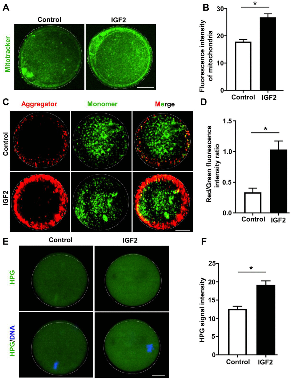 IGF2 improves the mitochondrial functional activity of oocytes from aged mice. (A) Mitochondria were stained with mitotracker Green FM (green). Scale bar = 20 μm. (B) Quantification of mitochondrial distribution signals in control oocytes (n = 26) and IGF2-treated oocytes (n = 25). A Student’s t-test (two-tailed). *p C) JC-1 staining showing the mitochondrial membrane potential (MMP) in control and IGF2-treated oocytes. (D) Quantification of the red/green fluorescence intensity ratio in control oocytes (n = 40) and IGF2-treated oocytes (n = 35). A Student’s t-test (two-tailed). *p E) HPG Fluorescent staining showing total protein synthesis in MII-stage oocytes with or without IGF2-treatment. Oocytes were incubated in M16 medium with 50 μM HPG for 1 h prior to staining. Scale bar = 30 μm. (F) Quantification of HPG signal intensity in control (n = 28) and IGF2-treated (n = 29) oocytes. *p t-test (two-tailed). Error bars indicate the SEM.