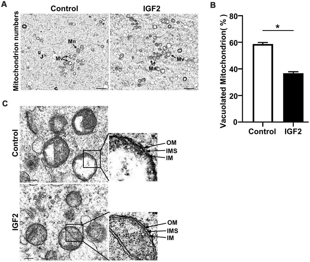 IGF2 improves the mitochondrial ultrastructure of oocytes from aged mice. (A) Representative TEM micrographs of mitochondria from control and IGF2-treated oocytes at 2,500x magnification. Scale bar = 1 μm. Note the normal (Mn) and vacuolated (Mv) mitochondria. (B) Quantification of mitochondria per defined region of interest (ROI) in control and IGF2-treated oocytes. n=9 oocytes for each group. A Student’s t-test (two-tailed). *p C) Representative TEM micrographs of mitochondria from control and IGF2-treated oocytes at 60,000x magnification. Inner membrane (IM), outer membrane (OM), and intermembrane space (IMS). Scale bar = 200 nm.