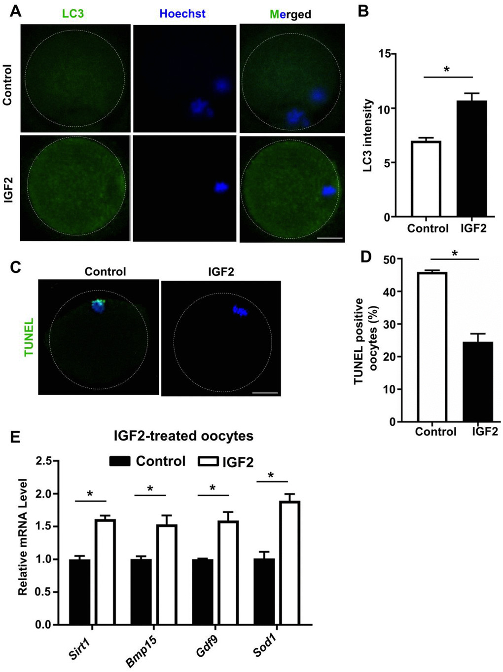 IGF2 reduces the apoptosis and promotes the level of autophagy in aged mouse oocytes. (A) LC3 staining showing the extent of autophagy occurring in control and IGF2-treated oocytes. (B) Quantification of LC3 intensity in control (n = 34) and IGF2-treated oocytes (n = 25). A Student’s t-test (two-tailed). *p C) TUNEL assay of control and IGF2-treated oocytes from aged mice. A green fluorescence signal indicates TUNEL-positive oocytes. Apoptotic signals were observed after 16 h of in vitro culture. DNA was counterstained with DAPI. Scale bar = 30 μm. (D) The percentage of apoptosis-positive oocytes in control (n = 61) and IGF2-treated oocytes group (n = 44). A Student’s t-test (two-tailed). *p E) qPCR results showing mRNA levels of Sirt1, Bmp15, Gdf9, and Sod1 in MII-stage oocytes after in vitro maturation with or without IGF2-treatment. *p t-test (two-tailed). Error bars indicate the SEM.