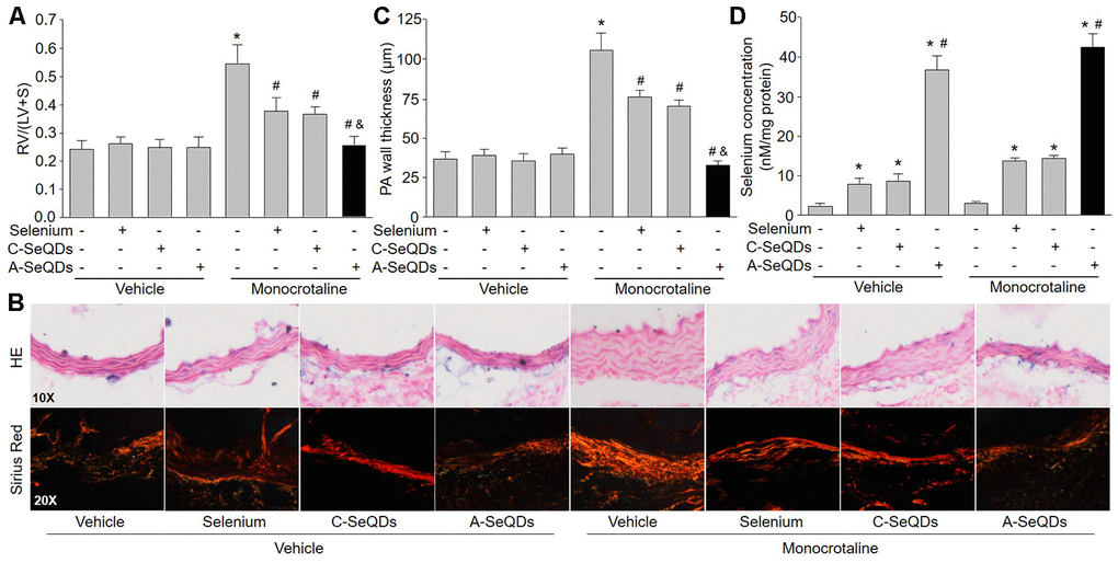 Administration of A-SeQDs improves pulmonary arterial remodeling in monocrotaline-injected mice. The experimental protocol was shown in Supplementary Figure 3A. At the end of experiment, mice were sacrificed under anesthesia. (A) The hearts were isolated to measure the ratio of right ventricle (RV) to left ventricle (LV) plus septum (S) weights [RV/(LV+S)]. (B and C) Pulmonary arteries were subjected to perform HE staining and sirius red staining in B. The thickness of pulmonary artery was calculated in C. All data were expressed as mean ± SEM. 10-15 mice were in each group. *PVS Vehicle alone, #PVS monocrotaline alone. &PVS monocrotaline plus Selenium or C-SeQDs. (D) The content of selenium in lung tissue was determined. *PVS Vehicle or monocrotaline alone, #PVS. monocrotaline plus Selenium or C-SeQDs. A one-way ANOVA followed by Tukey post-hoc tests was used to produce the P values.