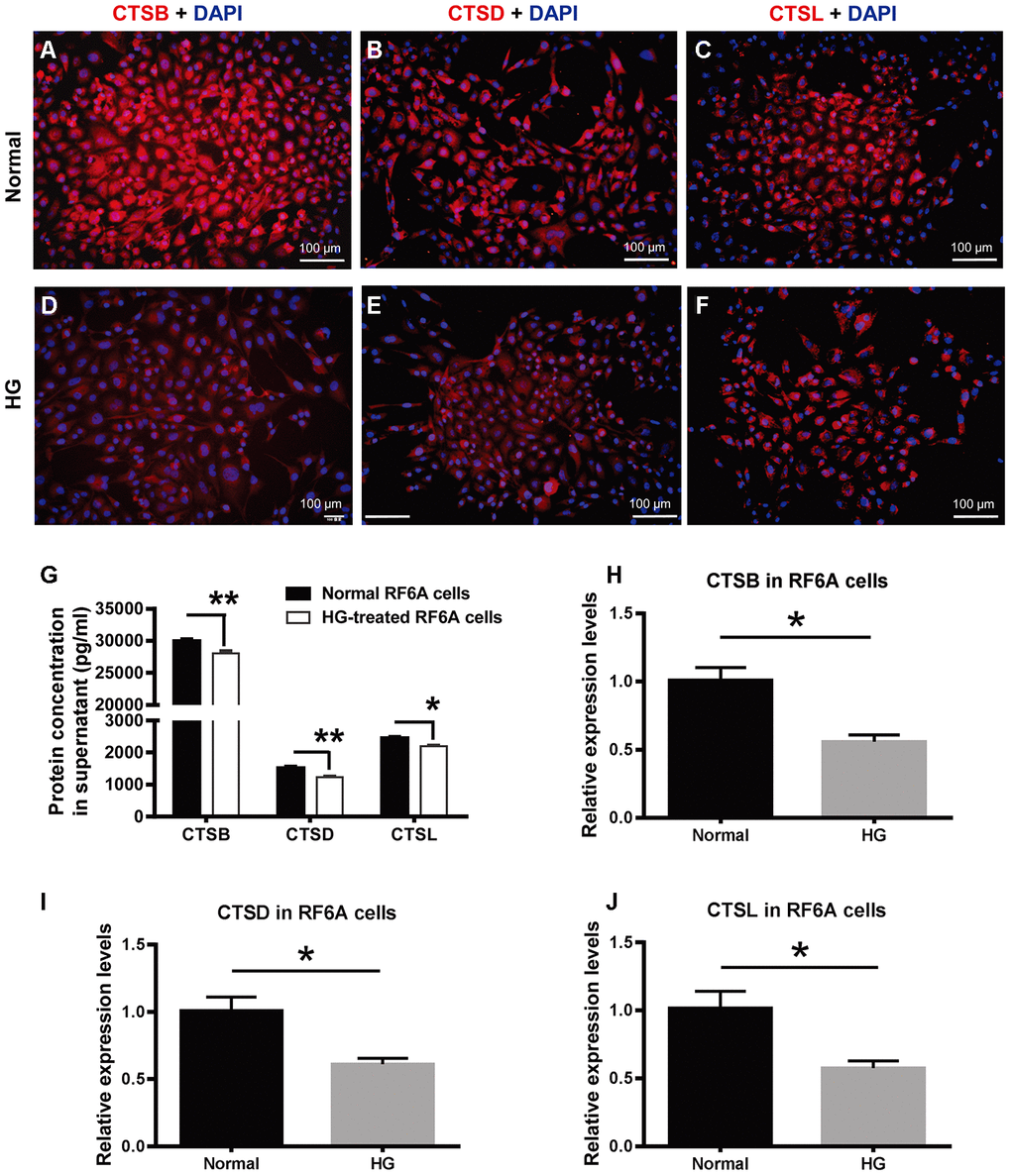 The expression of CTSB, CTSD, and CTSL in retinal vascular endothelial cells treated with high glucose. (A–F) The immunofluorescence of CTSB, CTSD, and CTSL proteins in the HG-treated simian retinal vascular endothelial cells (RF/6A) and normal controls. Scale bar = 100 μm (G) The concentrations of CTSB, CTSD, and CTSL proteins in RF/6A cell culture supernatant. (H–J) The relative expression levels of CTSB, CTSD, and CTSL genes in HG-stimulated and normal RF/6A cells. n = 6 / group. Data are expressed as mean ± SEM. * P P 