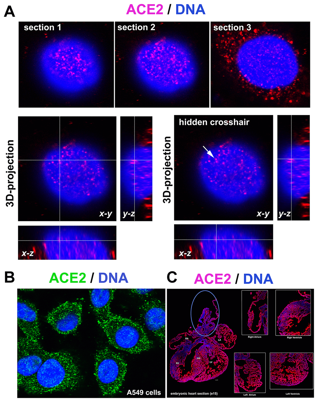 ACE2 in lung A549 cells and mouse embryonic heart sections. (A) 3D-projection of images obtained by confocal microscopy. The ACE2 protein (red fluorescence) was visualized by immunofluorescence. (B) ACE2 protein (green fluorescence) expression in A549 cells. (C) ACE2 expression in mouse heart section (red fluorescence) [see right atrium (RA), left atrium (LA), aorta (AO) and pulmonary trunk (PT), right ventriculus (RV), and left ventriculus (LV) or intraventricular septum (IVS)]. The blue ellipse shows the anatomical part associated with the aorta.