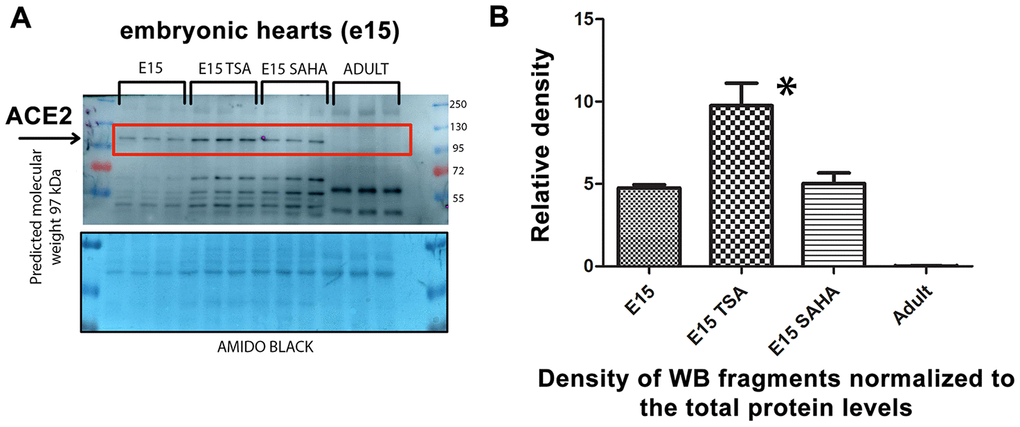 Level of the ACE2 protein studied in explanted embryonic hearts treated by HDAC inhibitors. (A) In nontreated, TSA (trichostatin A), and SAHA (suberoylanilide hydroxamic acid)-treated explanted mouse hearts at stage e15, the ACE2 protein level was analyzed. (B) Quantification of the protein levels, as assessed by western blotting, was performed using ImageJ software.