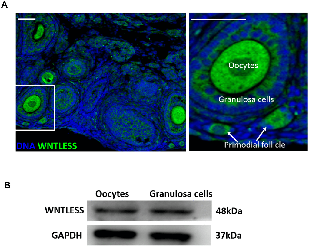 WNTLESS expression in the ovary. (A) The immunofluorescent staining of WNTLESS in the normal ovary. Green, WNTLESS; Blue, DNA. Scale bar, 100 μm. (B) The levels of WNTLESS protein in oocytes and granulosa cells are displayed by the western blot method. 200 oocytes and 106 granulosa cells were used.