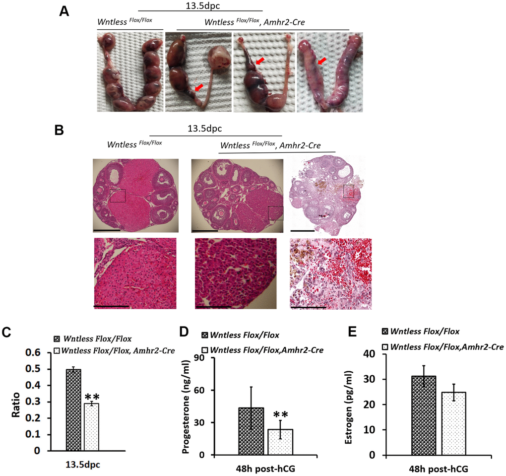 Subfertility results from miscarriage and smaller CL in GC-specific Wntless knockout mice. (A) Uteri collected from 13.5 dpc Wntless Flox/Flox and Wntless Flox/Flox, Amhr2-Cre mice. Red arrows indicate miscarriage locations. (B) Top row, representative images of one plane in ovaries, scale bar = 500 μm. The magnified images of a part of CL and hemorrhagic response are displayed in the second row, scale bar = 150 μm. (C) The area ratio of CL to the ovary for Wntless Flox/Flox (n=5) and Wntless Flox/Flox, Amhr2-Cre (n=6) mice at 13.5 dpc. (D) Serum progesterone levels in Wntless Flox/Flox (n=5) and Wntless Flox/Flox, Amhr2-Cre (n=6) mice at 13.5 dpc. (E) Serum estradiol levels in Wntless Flox/Flox (n=5) and Wntless Flox/Flox/Amhr2-Cre (n=6) mice at 13.5 dpc. In (C, D), **P.