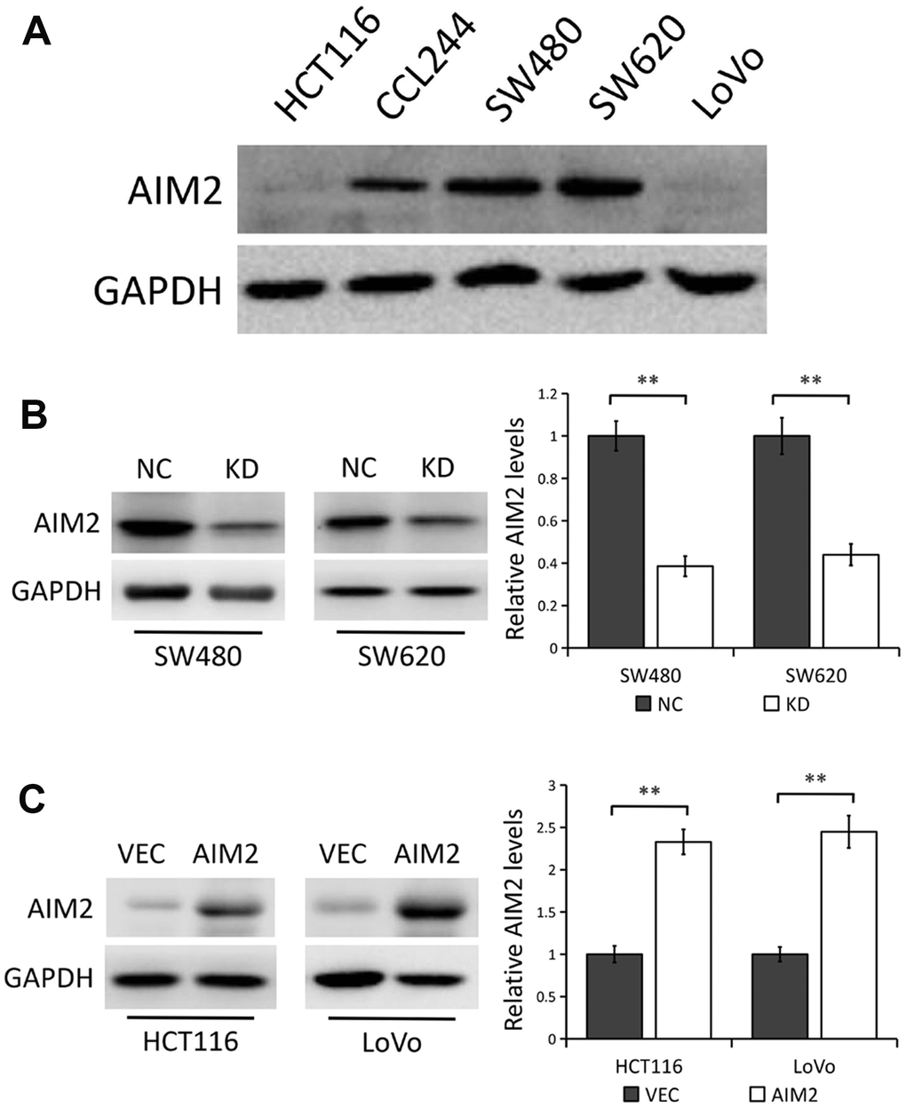 AIM2 protein expression in human CRC cell lines. (A) Western blots of AIM2 protein in five human CRC cell lines (HCT116, CCL244, SW480, SW620 and LoVo). GAPDH as a loading control. (B) Western blots of AIM2 protein in SW480 and SW620 cells stably transfected with control-shRNA (NC) or shRNA against AIM2 (KD). GAPDH as a loading control. Each experiment was performed at least triplicate and the bands were quantified and presented as the mean±SEM. (C) Western blots of AIM2 protein in HCT116 and LoVo cells stably transfected with empty vector (VEC) or plasmid encoding human AIM2 (AIM2). GAPDH as a loading control. Each experiment was performed at least triplicate and the bands were quantified and presented as the mean±SEM. **P