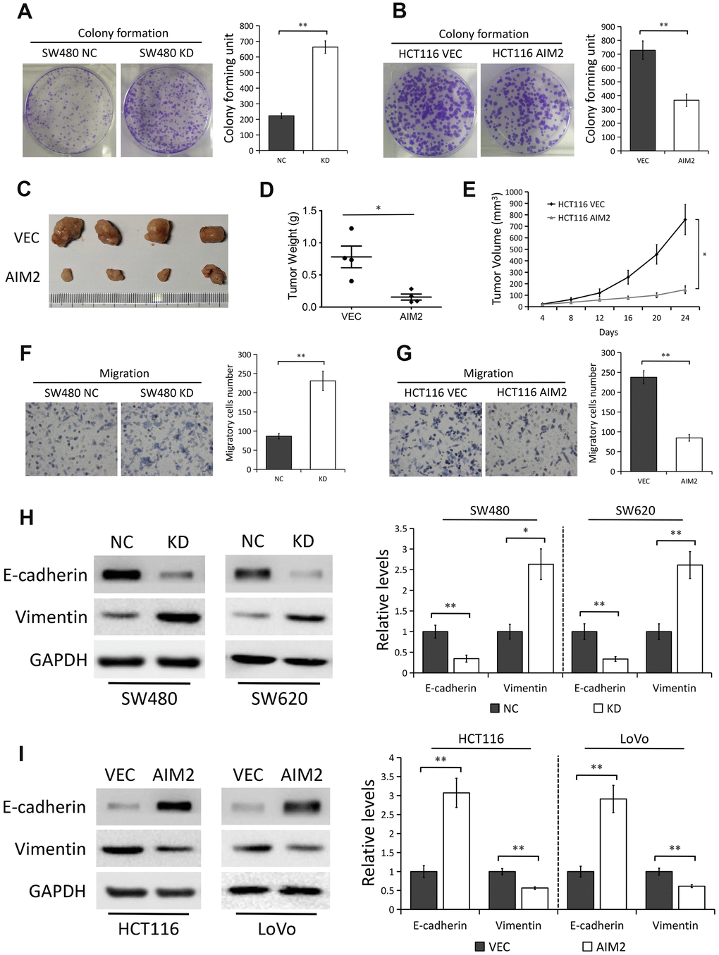 AIM2 plays anti-carcinogenic roles in CRC. (A) Colony formation assays to test viability of SW480 cells stably transfected with control-shRNA (NC) or shRNA against AIM2 (KD). Quantitative analysis results were presented as the mean±SEM (n=3). (B) Colony formation assays to test viability of HCT116 cells stably transfected with empty vector (VEC) or plasmid encoding human AIM2 (AIM2). Quantitative analysis results were presented as the mean±SEM (n=3). (C) Subcutaneous xenograft tumor growth in nude mice (4 per group) was measured and compared in HCT116 (VEC vs. AIM2) cell lines, and the representative image of tumors was shown. (D) Scatter plot analysis of tumor weight of each group was presented. (E) The volumes of the tumors measured every 4 days during the indicated period were shown. (F) Transwell assays to test migration ability of SW480 NC and KD cells. Quantitative analysis results were presented as the mean±SEM (n=3). (G) Transwell assays to test migration ability of HCT116 VEC and AIM2 cells. Quantitative analysis results were presented as the mean±SEM (n=3). (H) Western blots of E-cadherin and Vimentin protein in SW480 and SW620 cells stably transfected with control-shRNA (NC) or shRNA against AIM2 (KD). GAPDH as a loading control. Each experiment was performed at least triplicate and the bands were quantified and presented as the mean±SEM. (I) Western blots of E-cadherin and Vimentin protein in HCT116 and LoVo cells stably transfected with empty vector (VEC) or plasmid encoding human AIM2 (AIM2). GAPDH as a loading control. Each experiment was performed at least triplicate and the bands were quantified and presented as the mean±SEM. *P