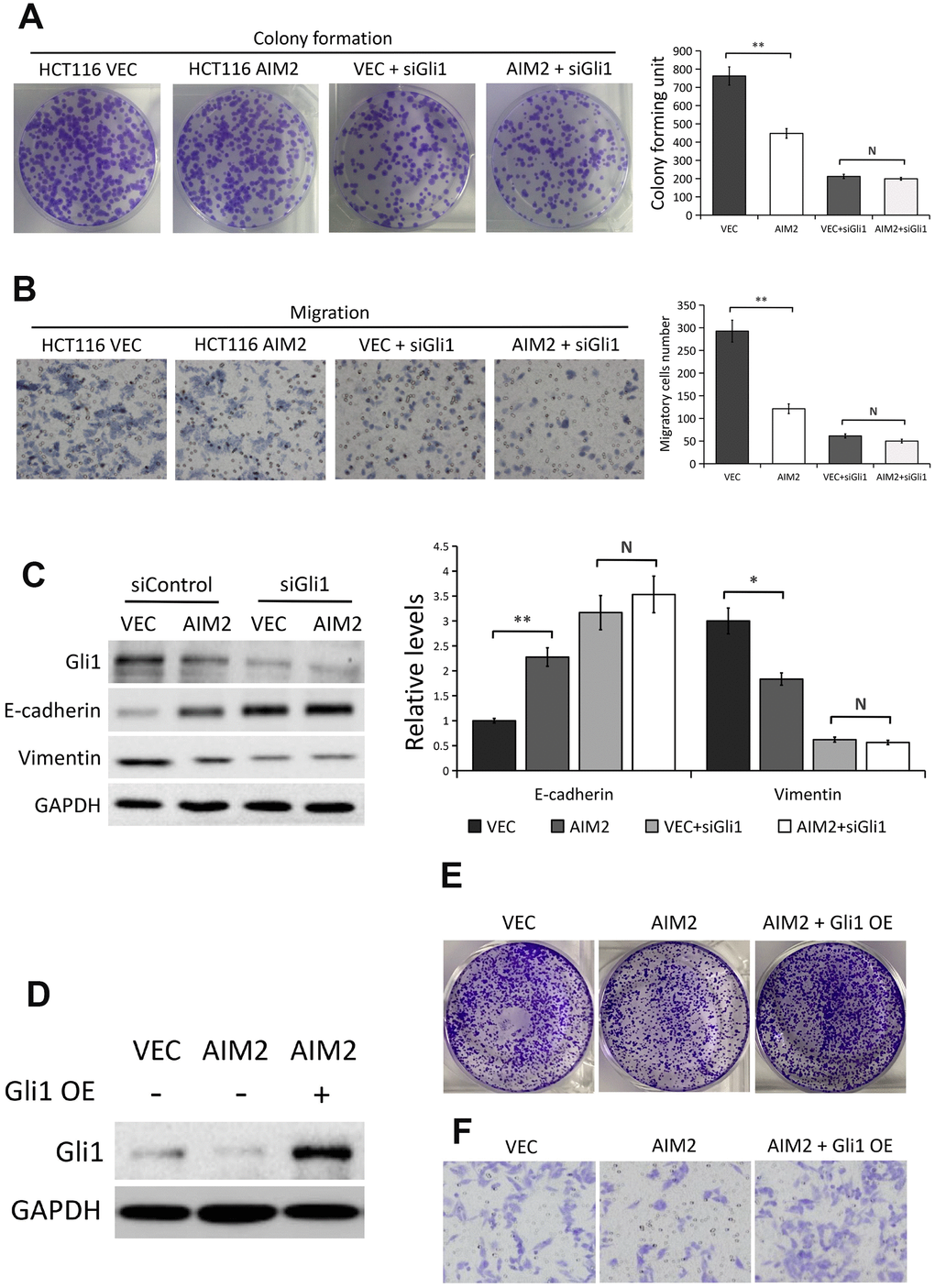 AIM2 inhibits HCT116 cell proliferation, migration and EMT progress in a Gli1-dependent manner. (A) Colony formation assays to test viability of HCT116 cells stably transfected with empty vector (VEC) or plasmid encoding human AIM2 (AIM2) with or without Gli1 siRNA treatment. Quantitative analysis results were presented as the mean±SEM (n=3). (B) Transwell assays to test migration ability of HCT116 cells stably transfected with empty vector (VEC) or plasmid encoding human AIM2 (AIM2) with or without Gli1 siRNA treatment. Quantitative analysis results were presented as the mean±SEM (n=3). (C) Western blots of E-cadherin and Vimentin protein expression in HCT116 cells stably transfected with empty vector (VEC) or plasmid encoding human AIM2 (AIM2) in the presence or absence of Gli1 siRNA. GAPDH as a loading control. Each experiment was performed at least triplicate and the bands were quantified and presented as the mean±SEM. (D) Western blots of Gli1 protein expression in LoVo (VEC vs. AIM2) cells transfected with plasmids encoding human Gli1 or empty vector. (E, F) Colony formation assay (E) and transwell assay in LoVo (VEC vs. AIM2) cells transfected with plasmids encoding human Gli1 or empty vector. N, nonsignificant, *P