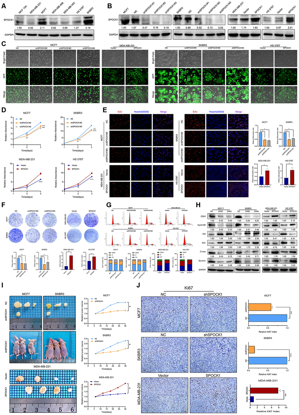 SPOCK1 influences BC cell growth. (A) Protein expression levels of SPOCK1 in BC cell lines as determined by western blot analysis. (B) MCF7/SKBR3 cells with SPOCK1 silencing and MDA-MB-231/HS 578T cells with SPOCK1 overexpression were established by viral transduction. The SPOCK1 levels in these established cell lines were verified by western blot analysis at 48 h after transfection. (C) Cells in bright light and GFP were captured to merge for displaying the transfection efficiency. (D) Cell viability was examined by MTT assay. (E) Results of EdU assay on BC cells. Representative photographs are shown at the original magnification, ×100. (F) Cell clonogenic capacity was measured by colony formation assay. (G) Flow-cytometry analysis was performed to detect cell cycle progression. (H) The expression of proteins related cell cycle (CDK1, Cyclin-B1, P21, P27, C-mvc and Survivin) was determined by western blot analysis. GAPDH was used as a loading control. (I) Xenograft tumors formed by injecting the indicated cells. Relative tumor volume curves were summarized in the line chart (*PJ) IHC staining of the proliferation marker Ki67 in xenograft tumors. The relative percentage of Ki67-positive cells was summarized in the bar charts. The P values were obtained using t-tests (***PP